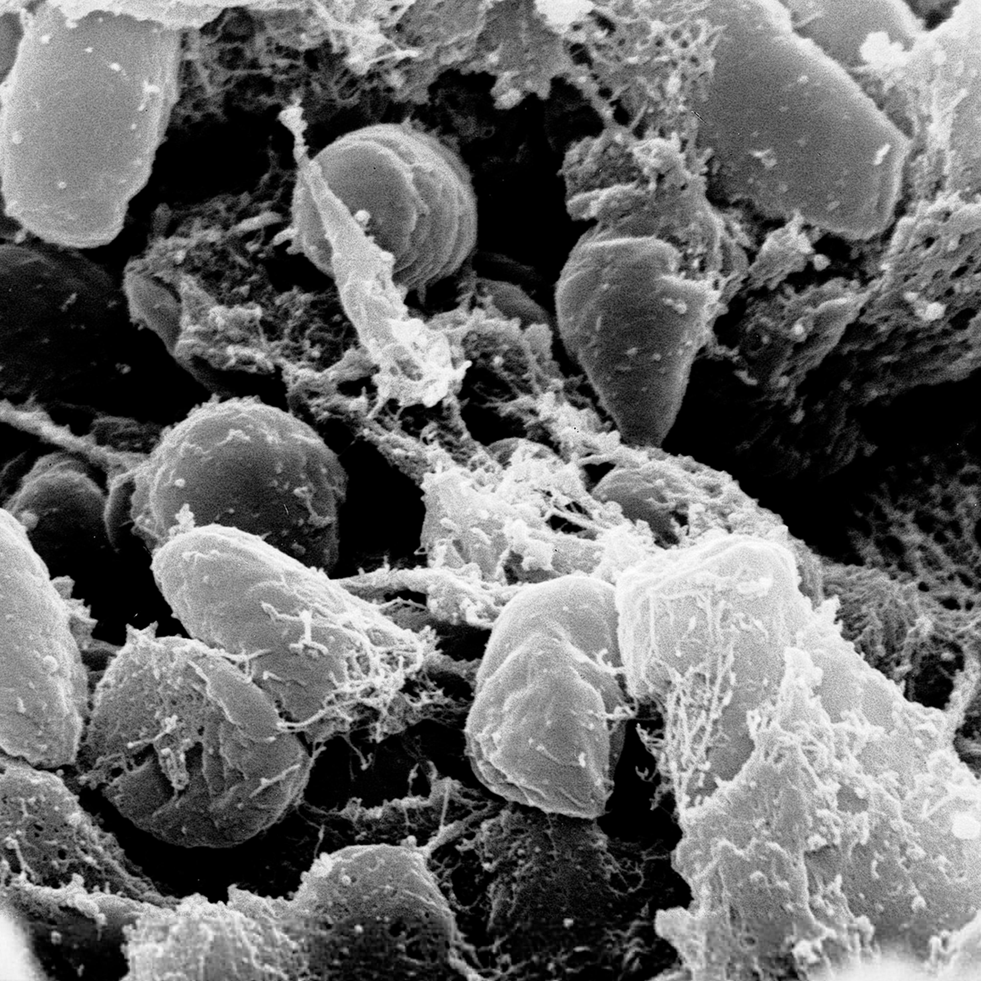 Yersinia Pestis SEM
