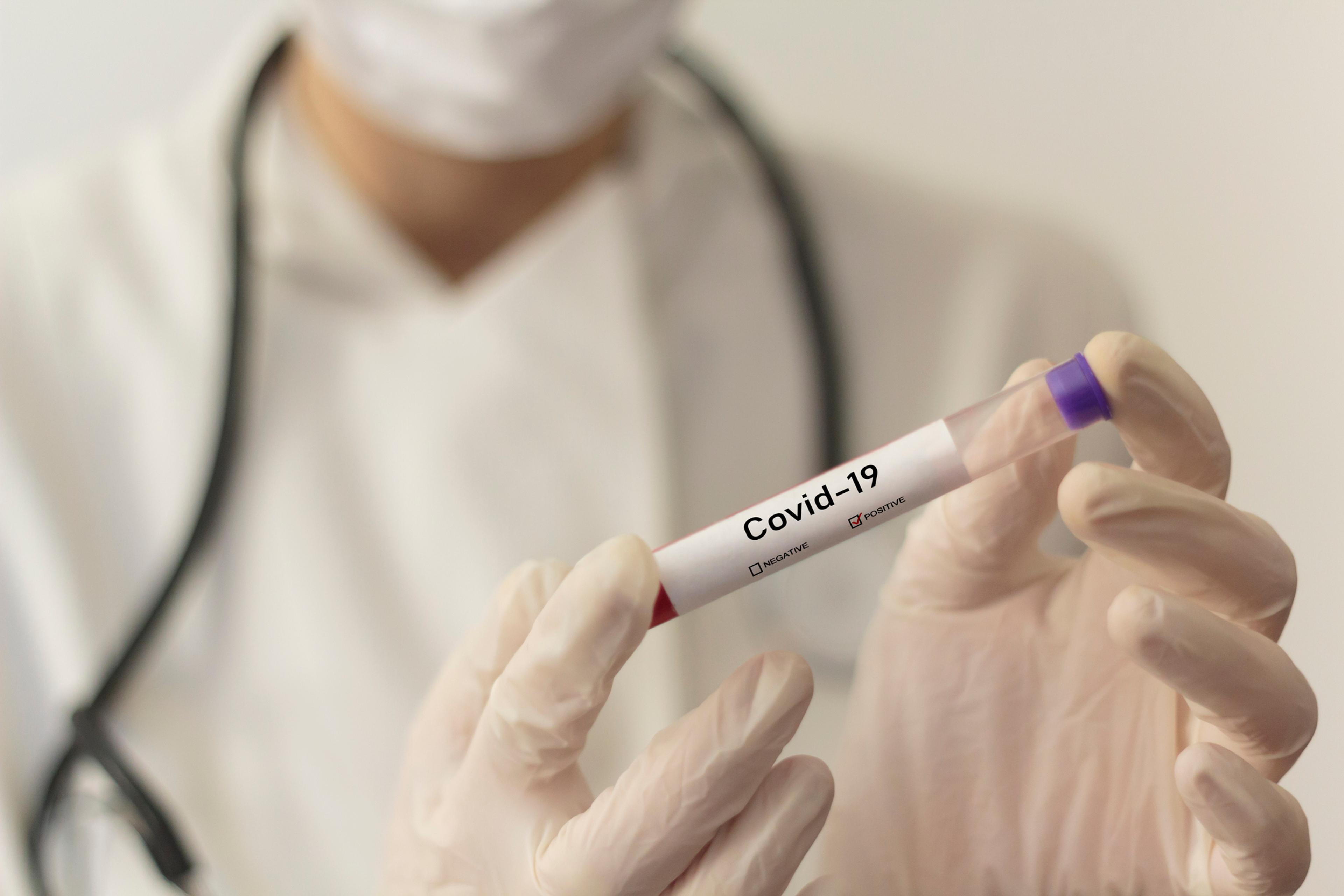Midsection Of Doctor Holding Test Tube In Laboratory