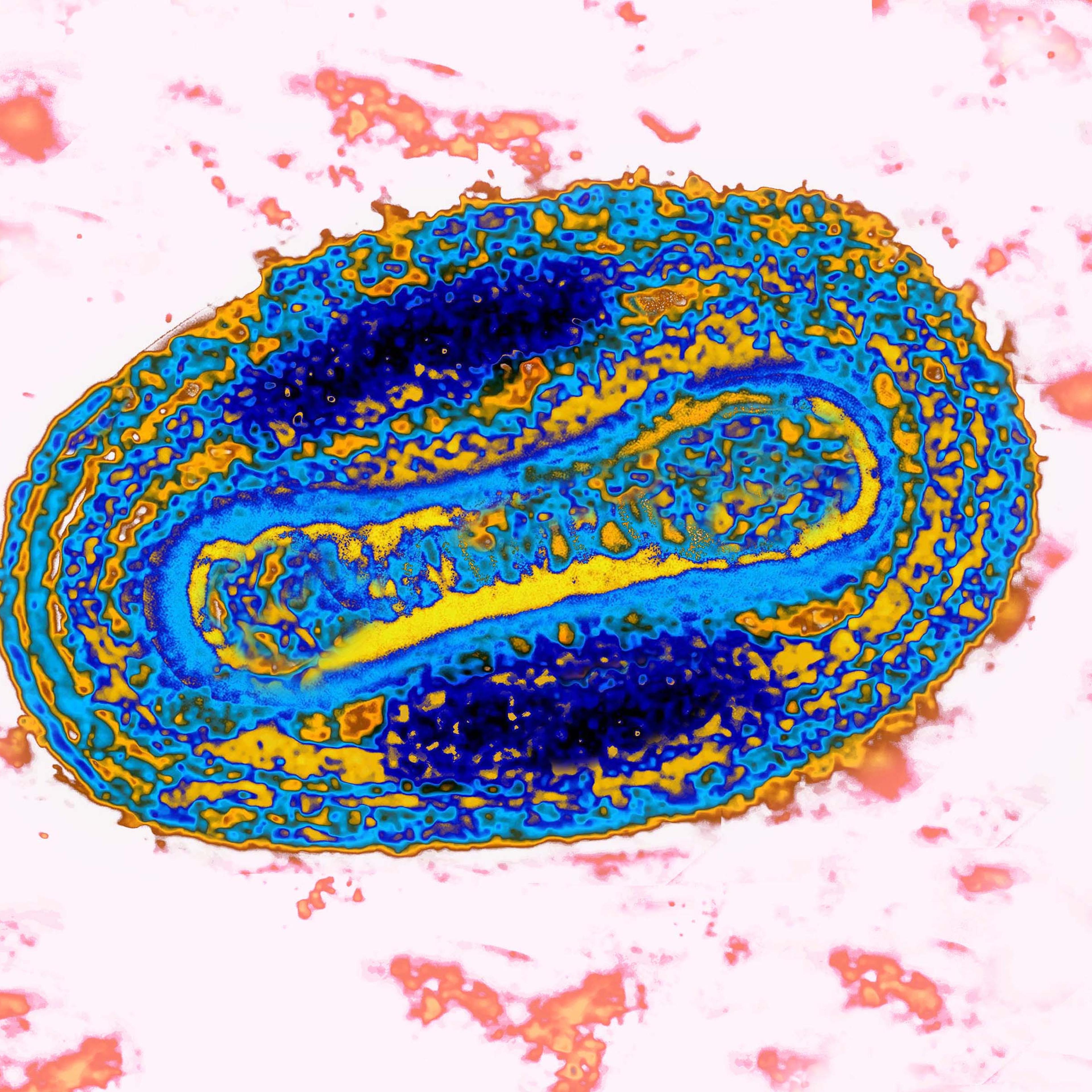 Pox Virus
