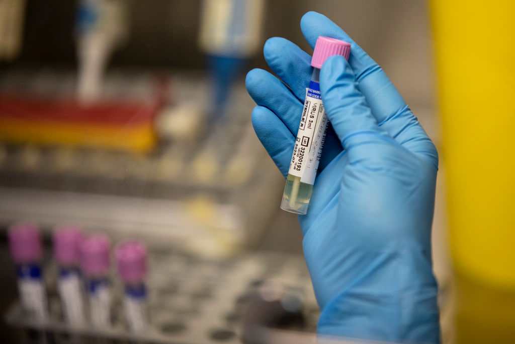 monkeypox-testing