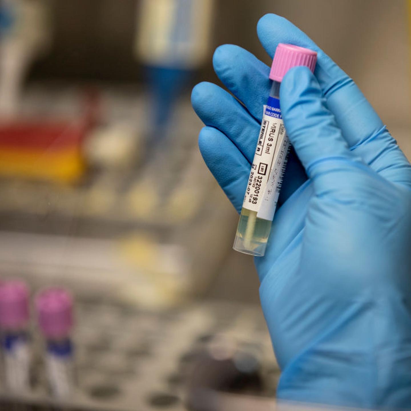 monkeypox-testing