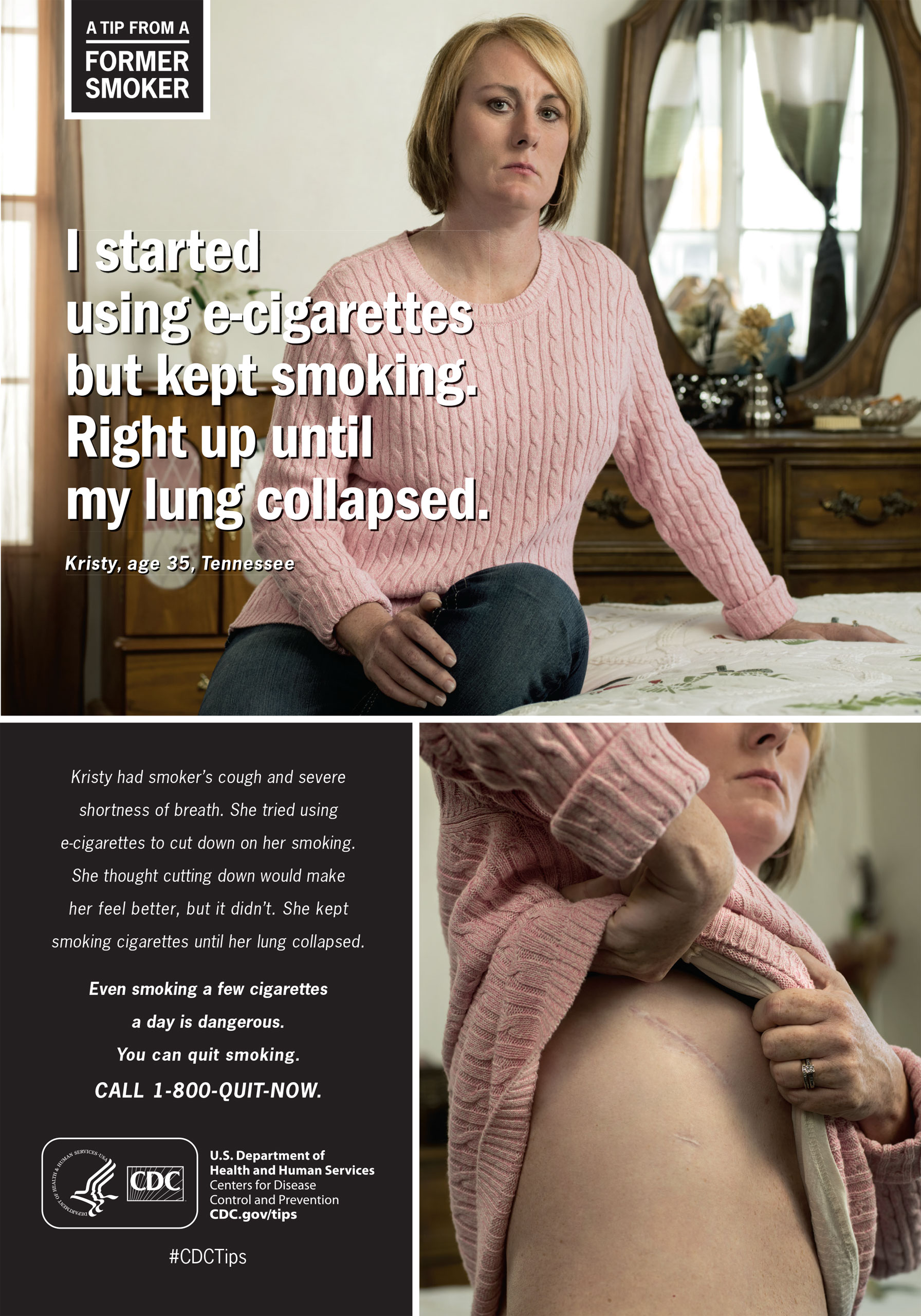 cdc gov cigarettes CDC's New Anti-Smoking Ads Targets E-Cigarettes
