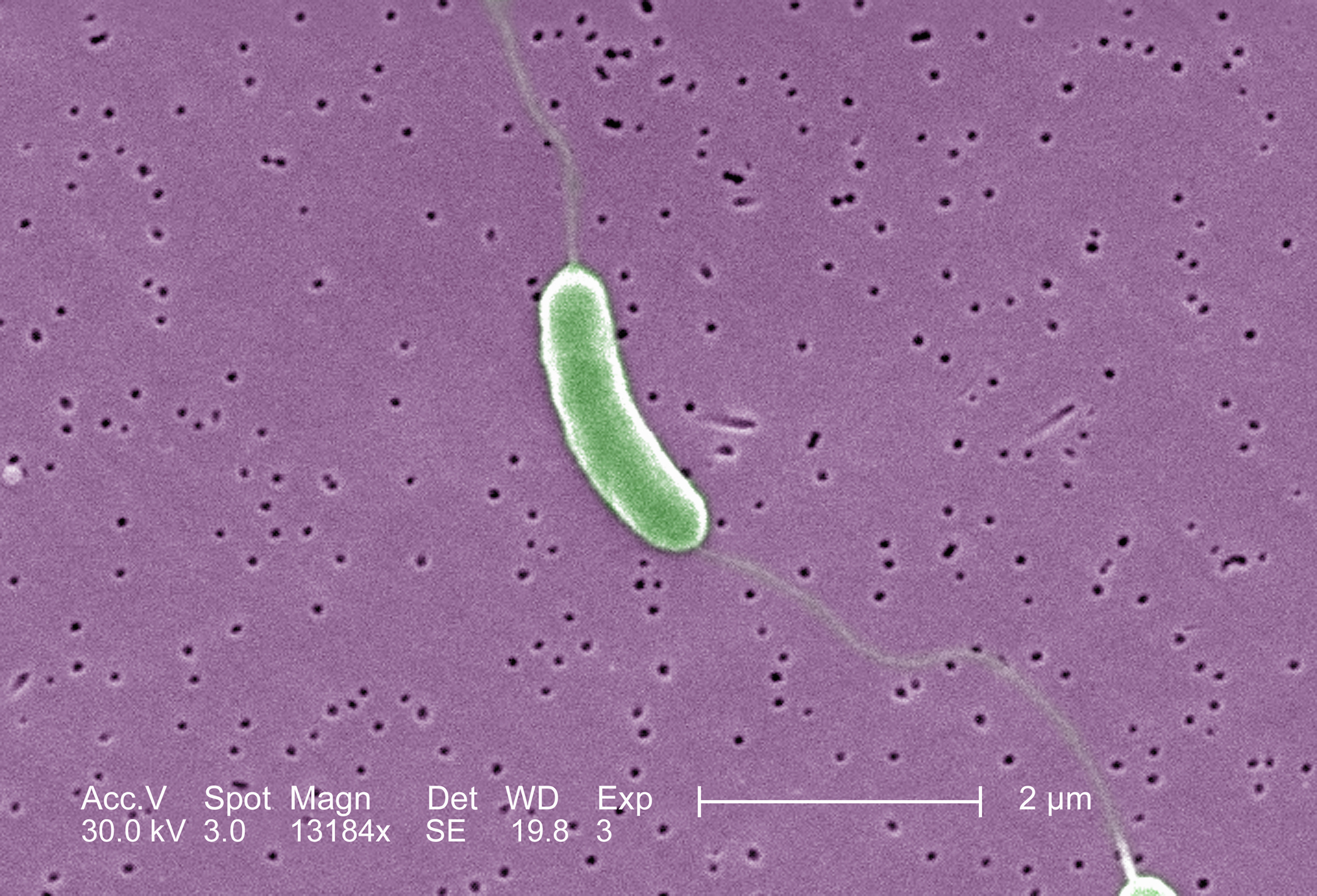 What to Know About the ‘Flesh-Eating’ Bacteria That Killed Someone in Florida
