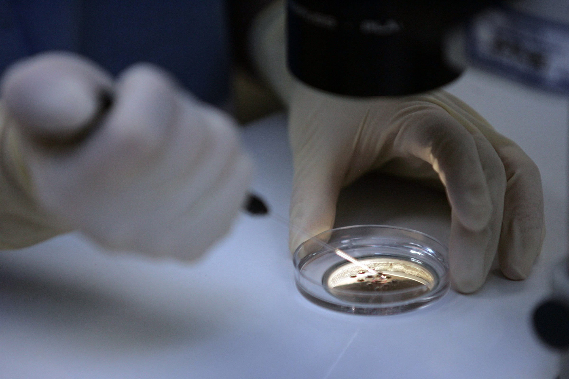 A doctor demonstrates how sperm is introduced collected ova to create embryos before they are placed under high-powered microscope for fertilization.