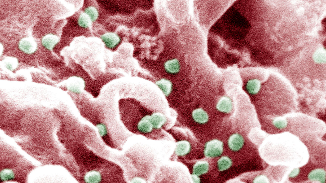 Scientists admit more testing is necessary, but a gel that could protect women from the spread of HIV is one step closer to the marketplace.