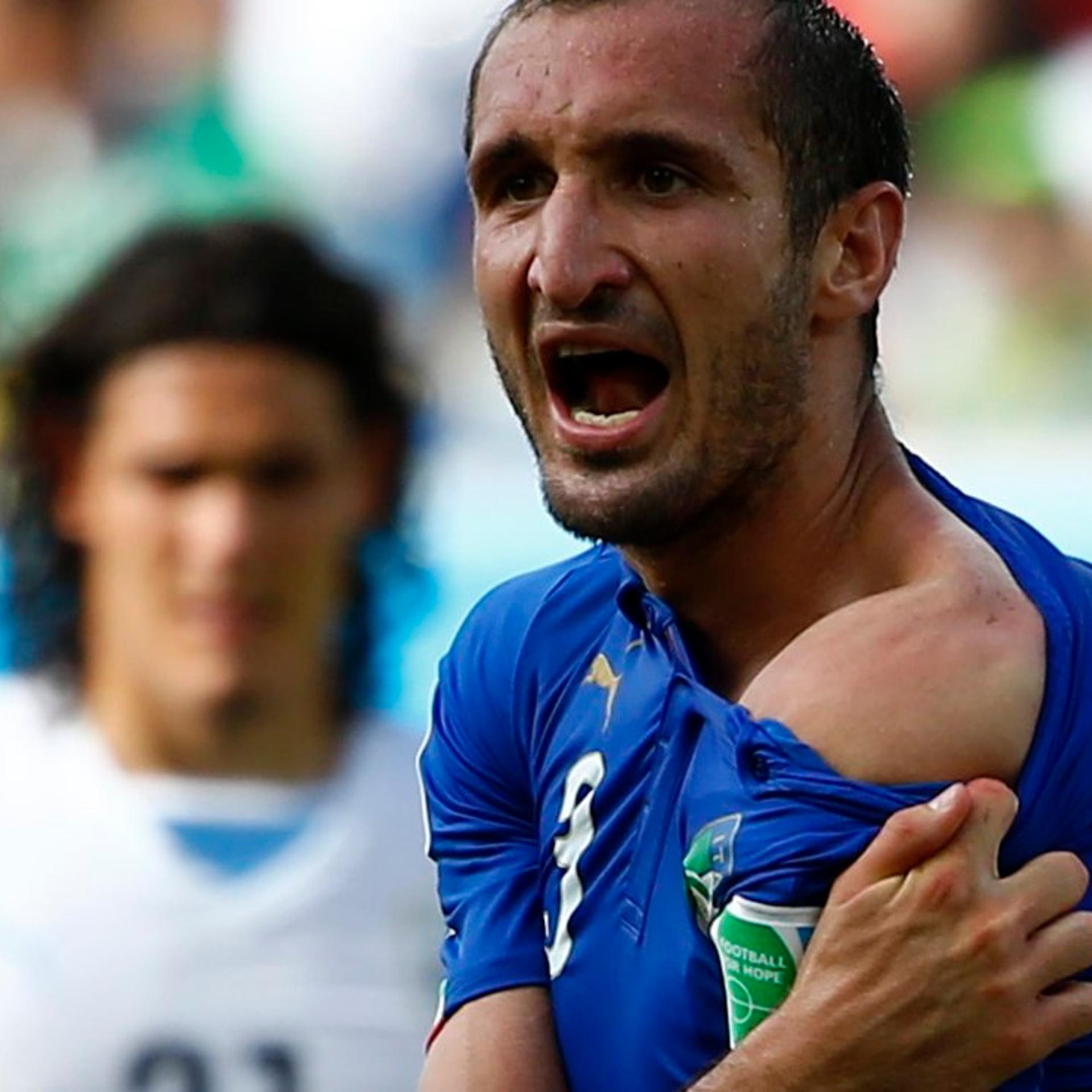 Italy's Giorgio Chiellini shows his shoulder, claiming he was bitten by Uruguay's Luis Suarez, during their 2014 World Cup Group D soccer match at the Dunas arena in Natal, Brazil on June 24, 2014.