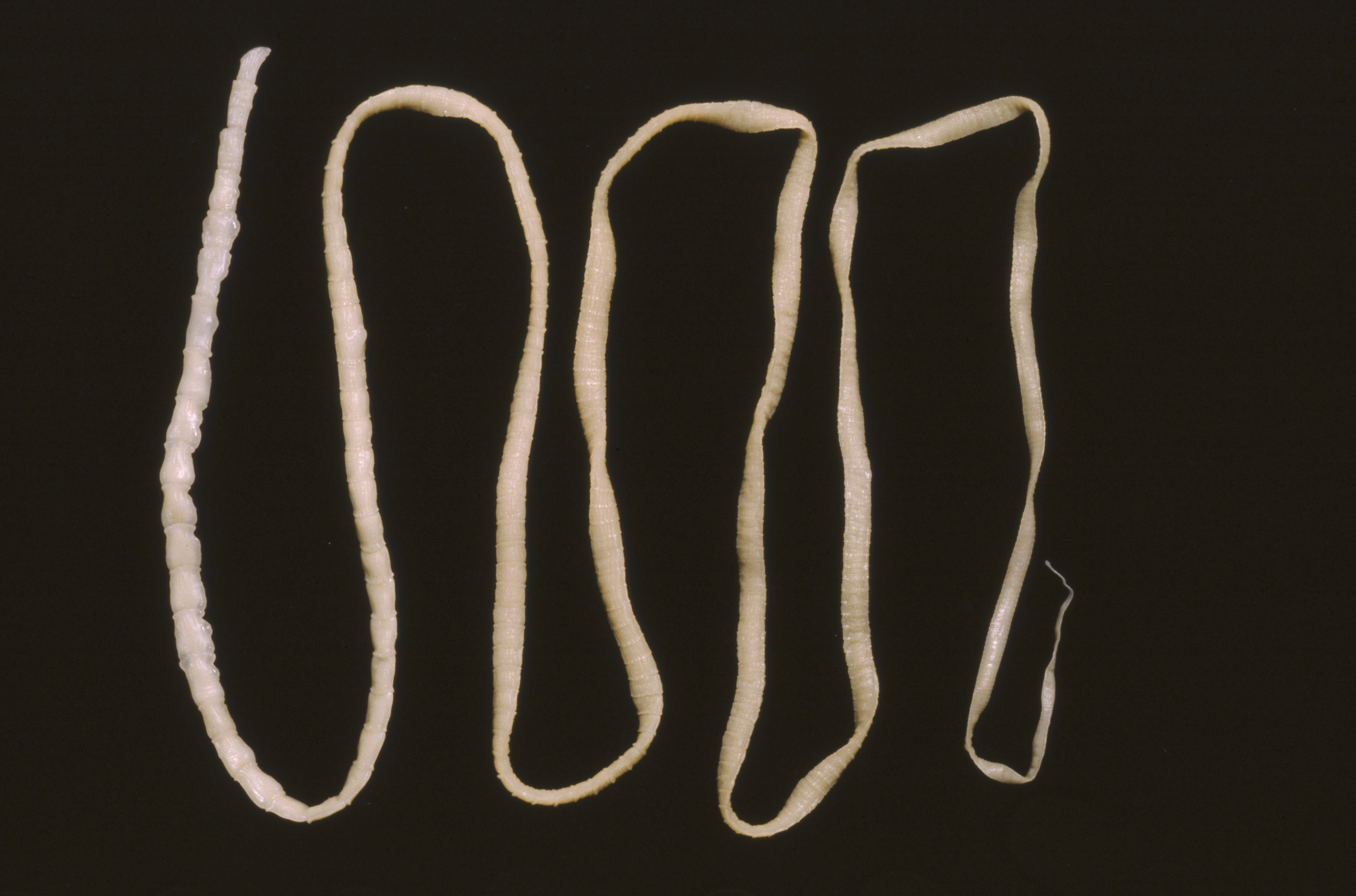 tapeworm