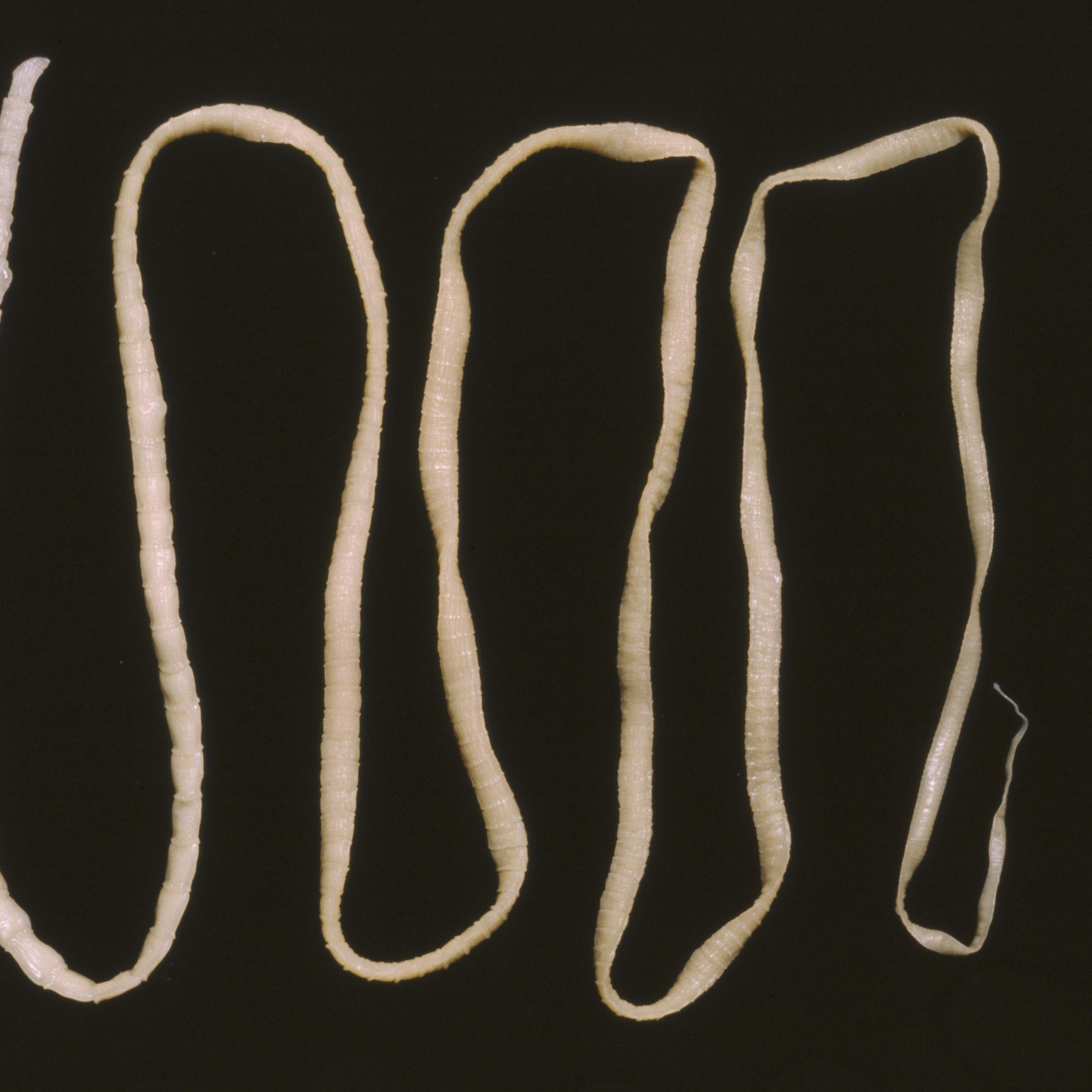 tapeworm