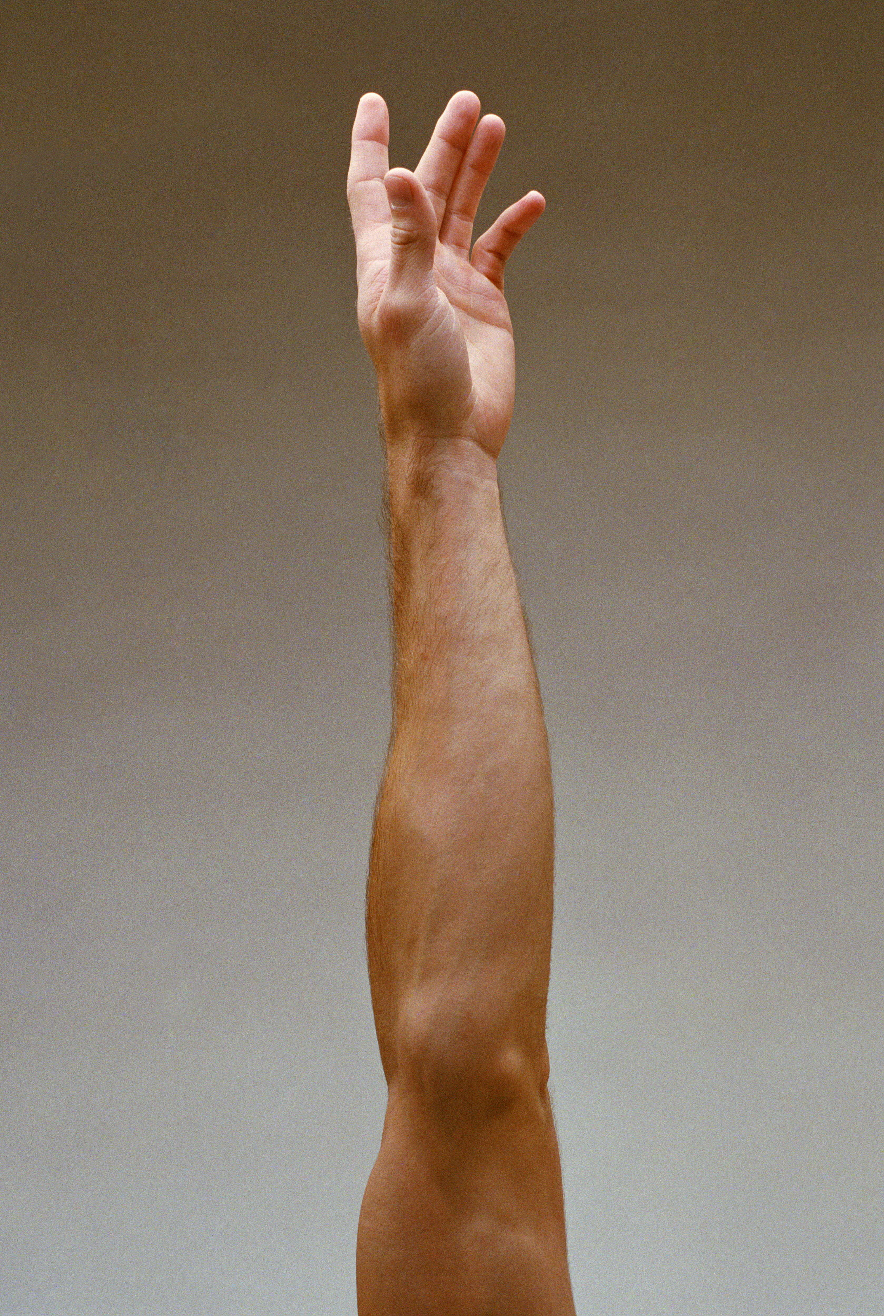 arm