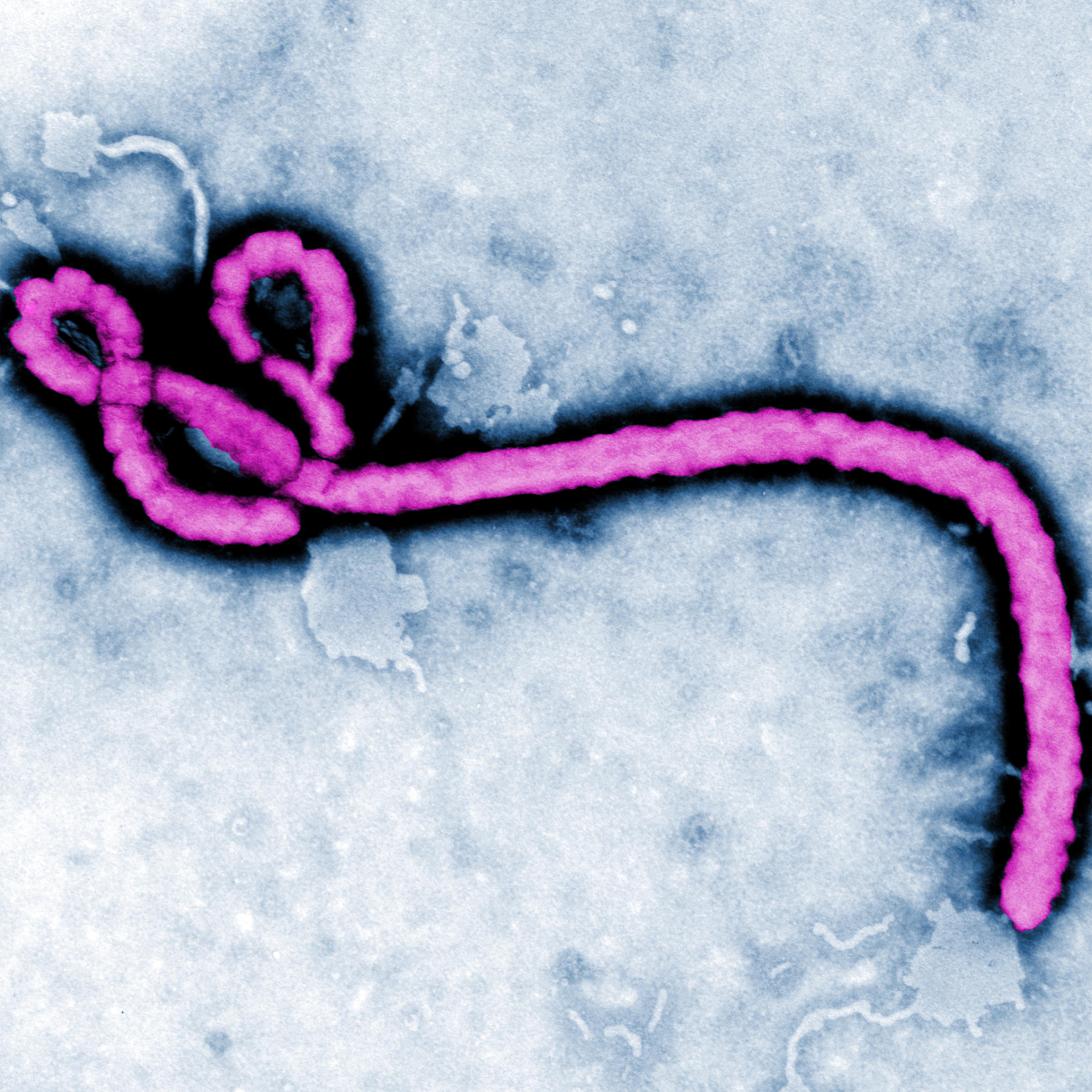 Colorized transmission electron micrograph (TEM) of the Ebola virus.