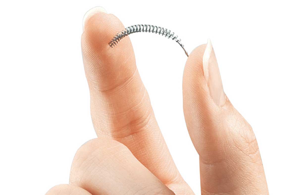 Essure