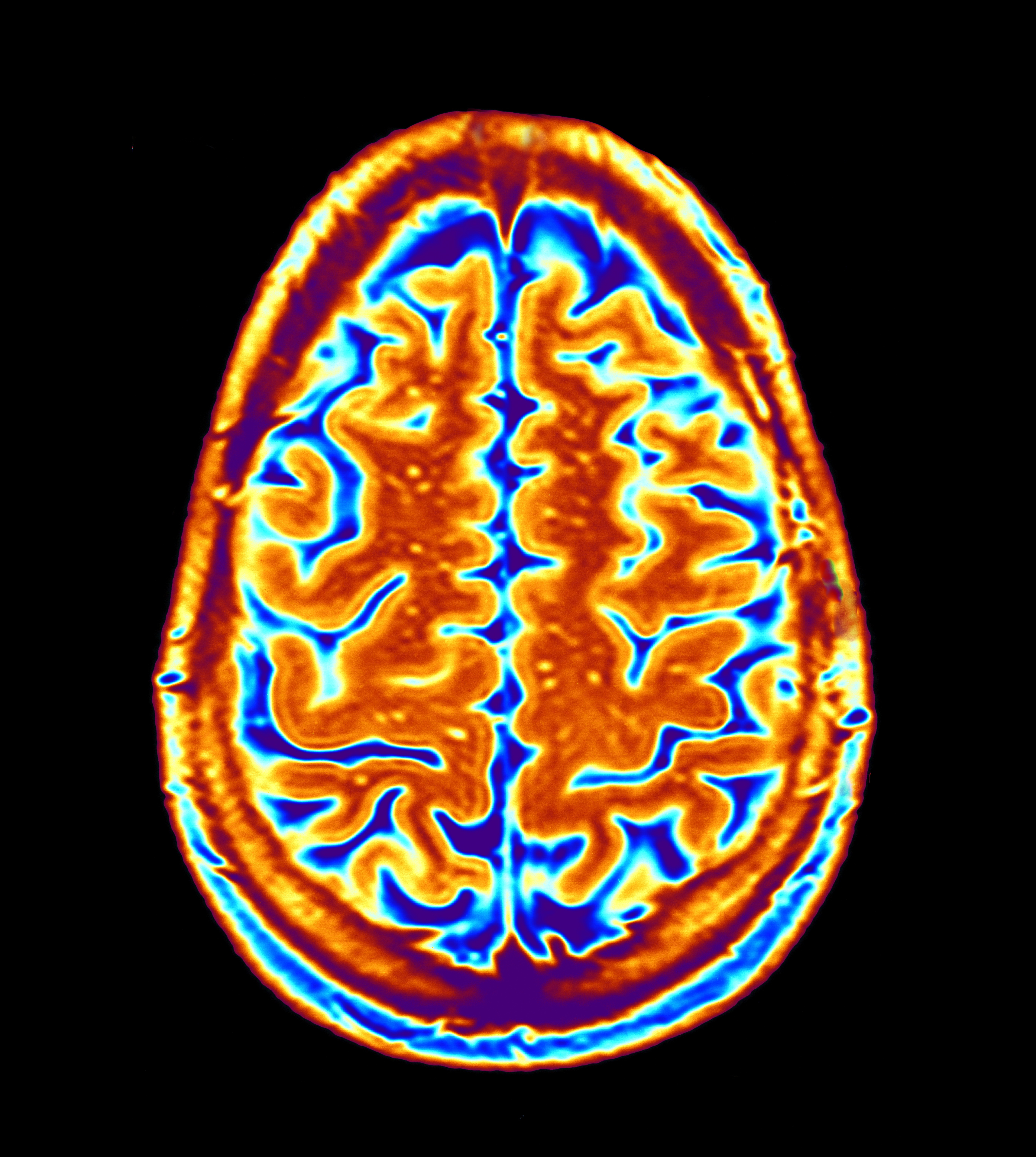 brain scan fmri mri