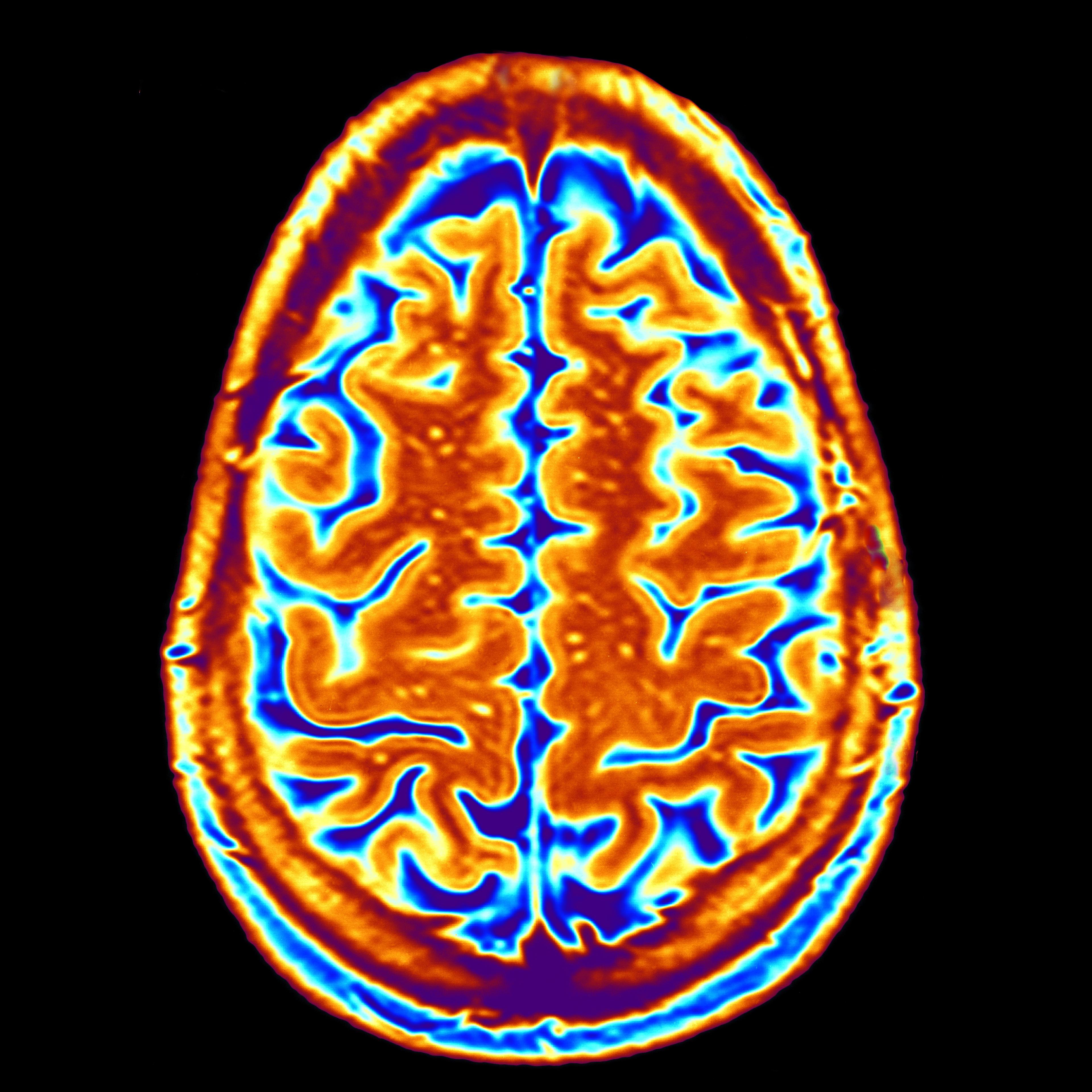 brain scan fmri mri