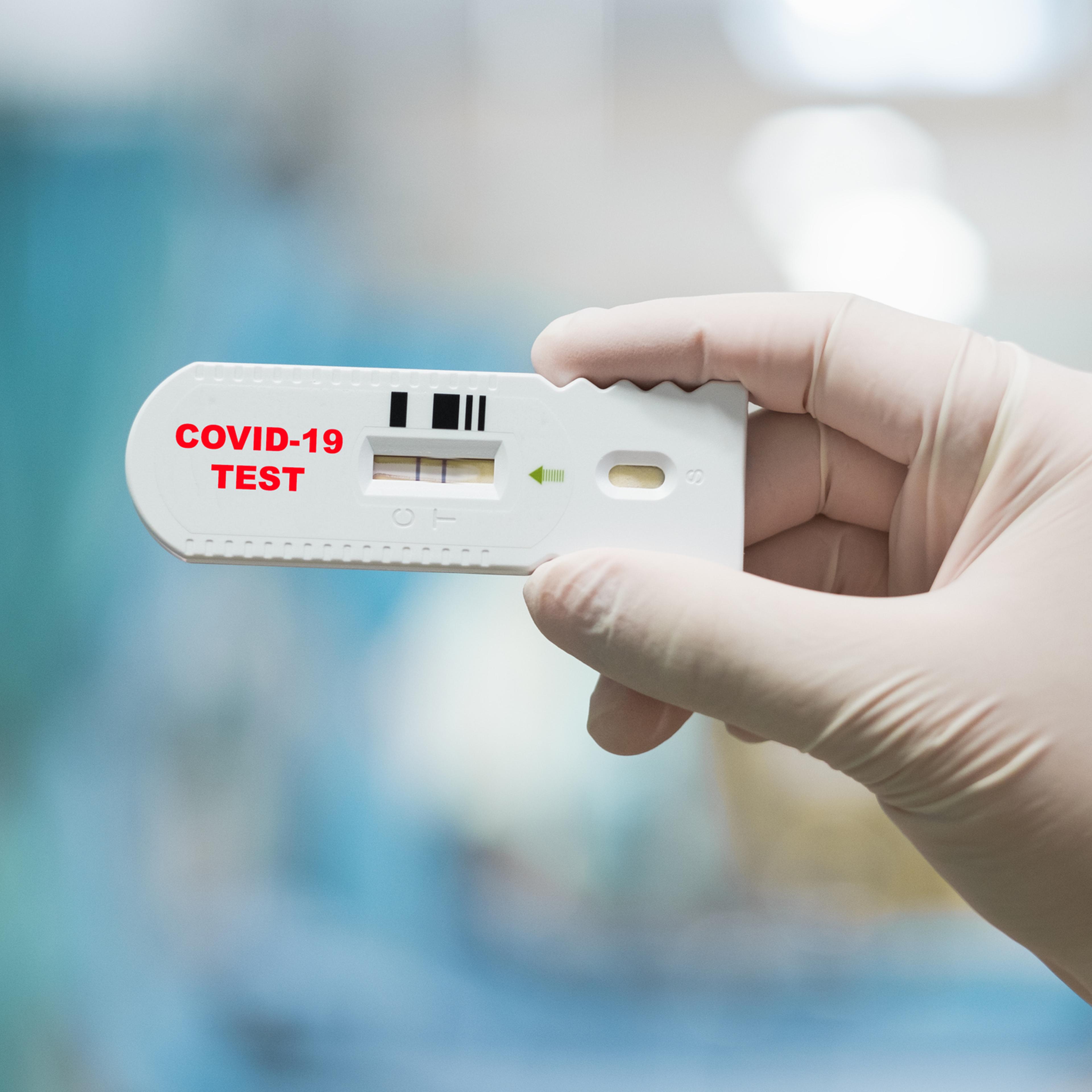 Doctor hand holding positive Coronavirus or Covid-19 rapid test