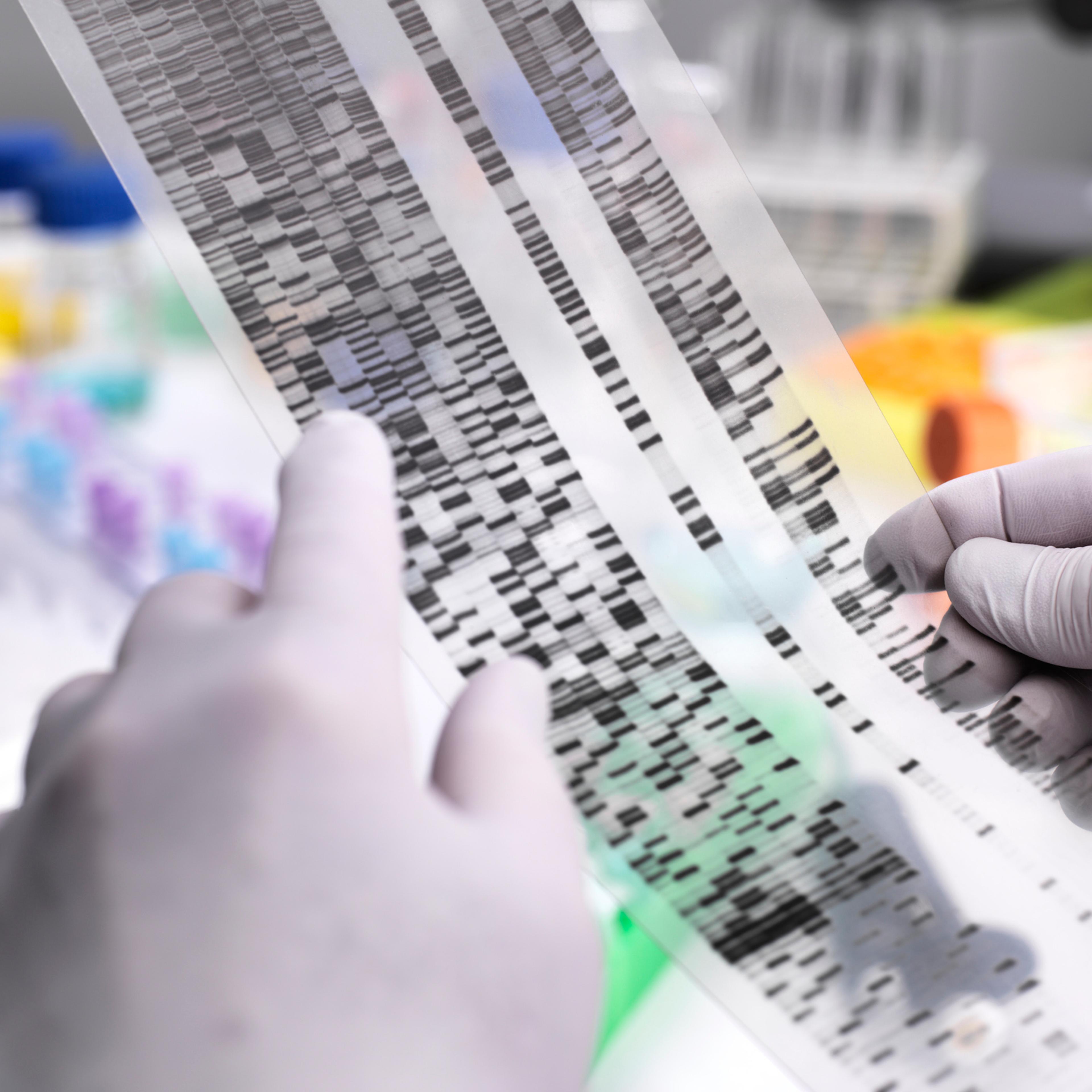 Genetic Research, Scientist holding a DNA gel revealing, the genetic make-up of the specimen