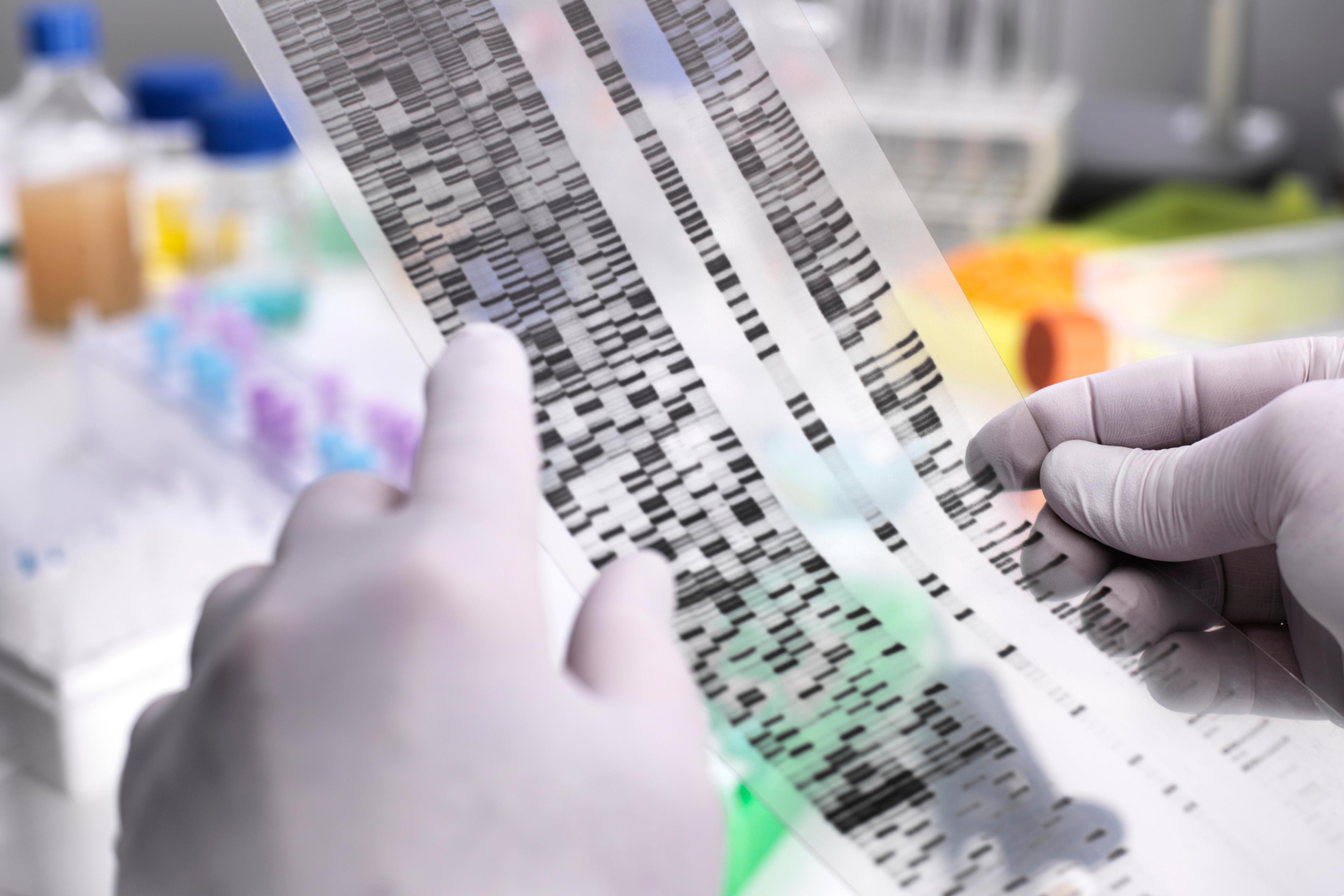 Genetic Research, Scientist holding a DNA gel revealing, the genetic make-up of the specimen
