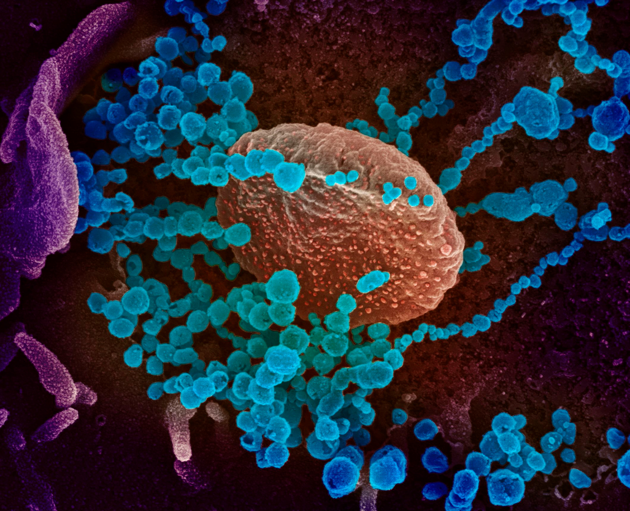 This image obtained on March 12 shows a scanning electron microscope image of SARS-CoV-2 (round blue objects) emerging from the surface of cells cultured in the lab, SARS-CoV-2, also known as 2019-nCoV, is the virus that causes COVID-19, the virus shown was isolated from a patient in the U.S.