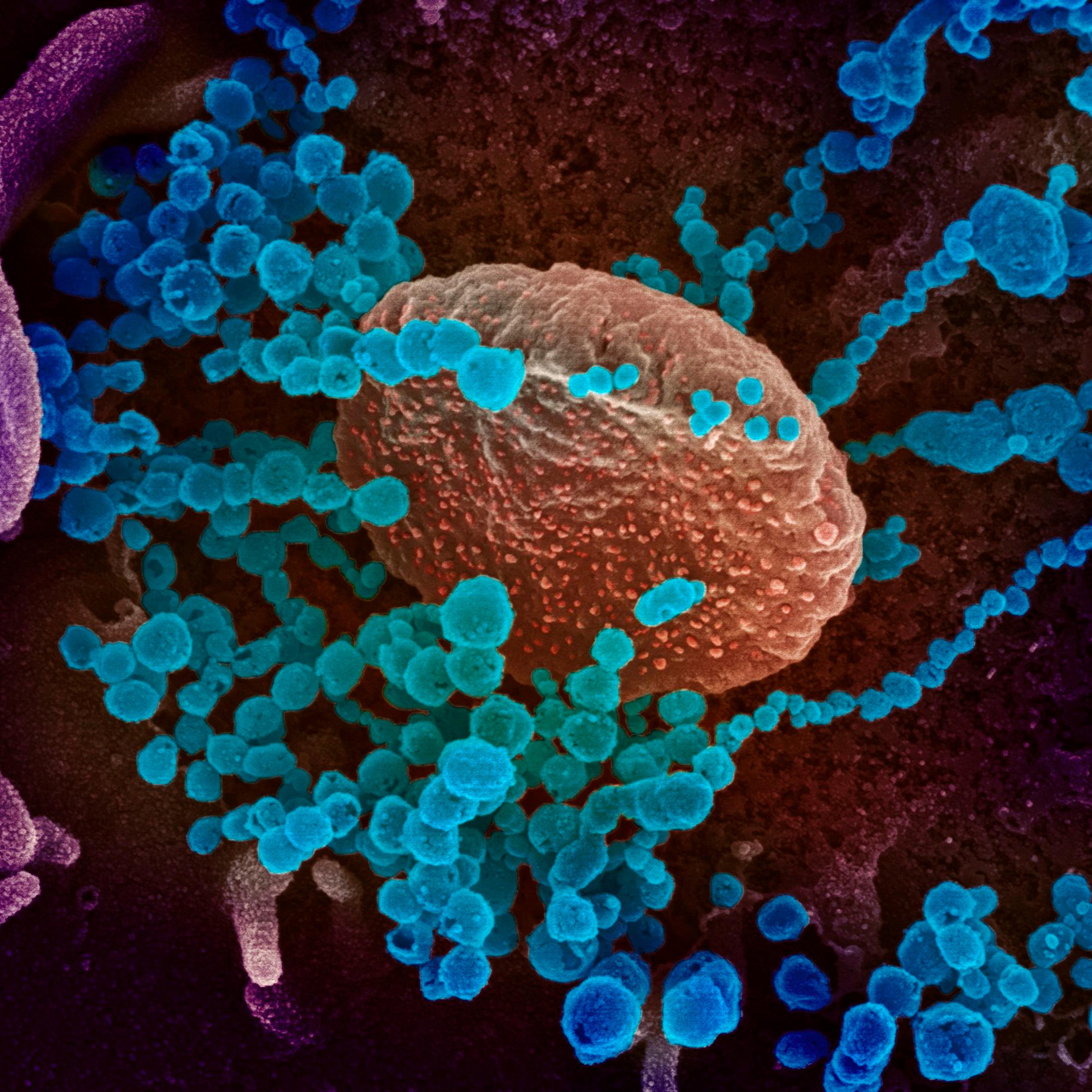 This image obtained on March 12 shows a scanning electron microscope image of SARS-CoV-2 (round blue objects) emerging from the surface of cells cultured in the lab, SARS-CoV-2, also known as 2019-nCoV, is the virus that causes COVID-19, the virus shown was isolated from a patient in the U.S.
