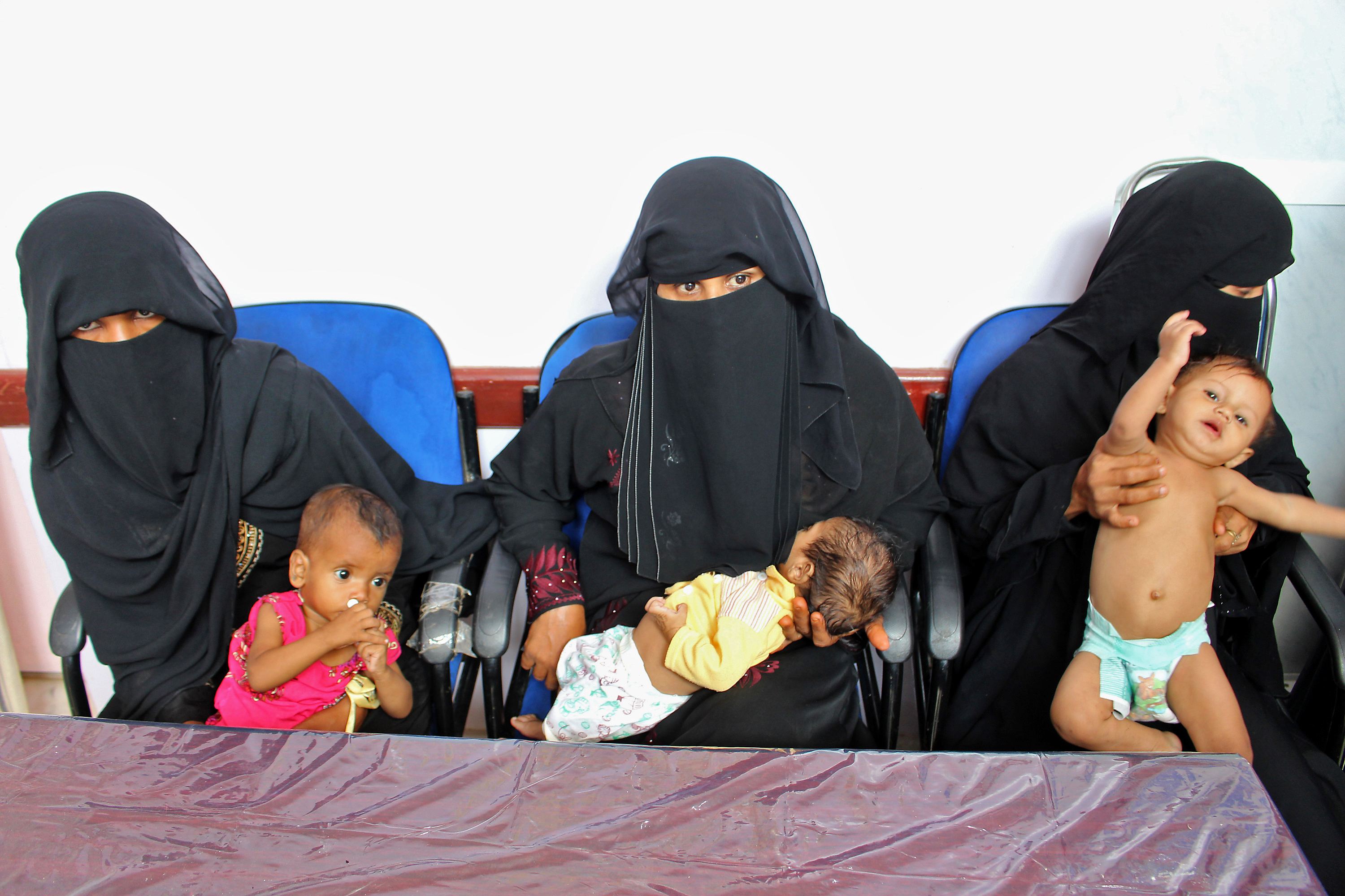 YEMEN-CONFLICT-HEALTH-CHILDREN