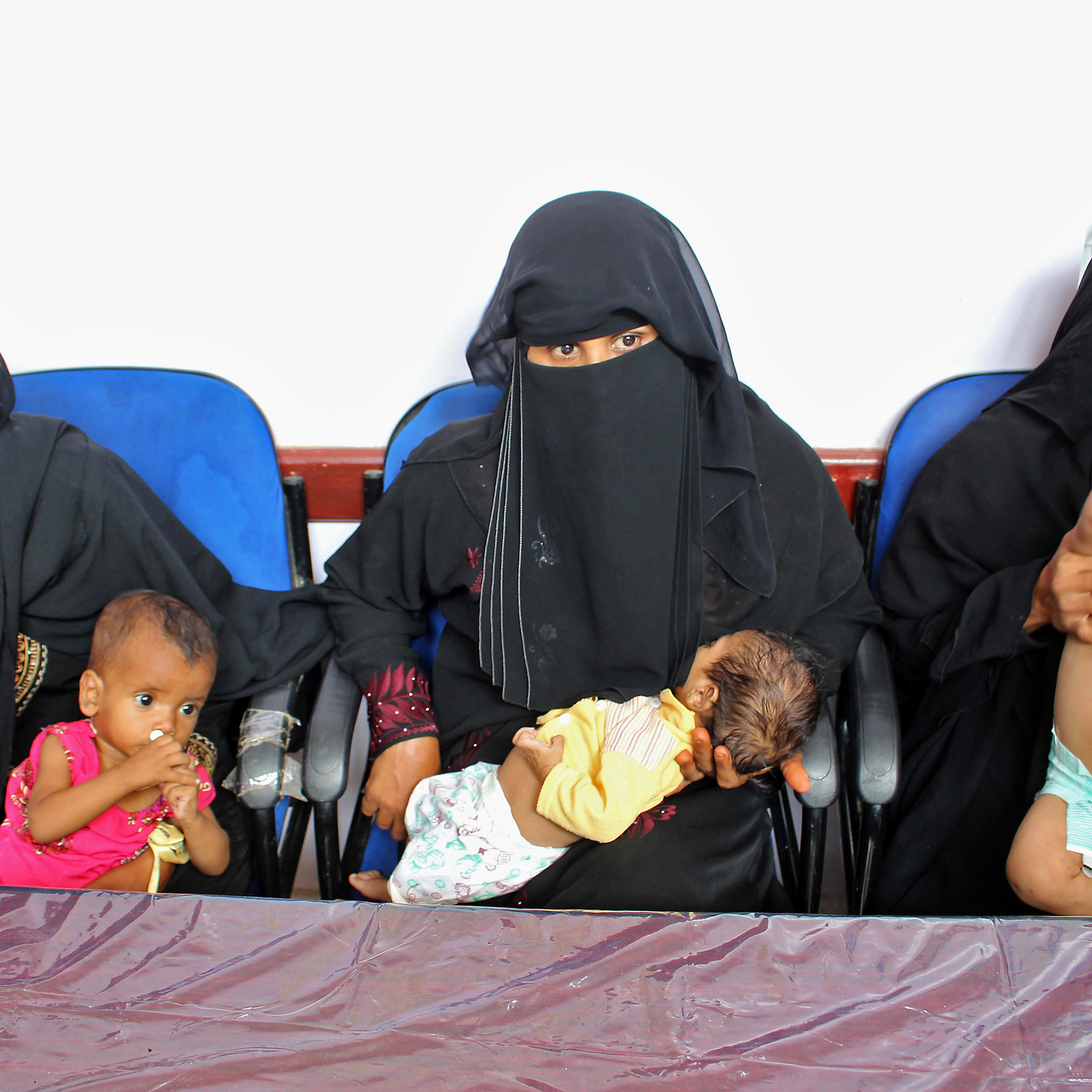 YEMEN-CONFLICT-HEALTH-CHILDREN