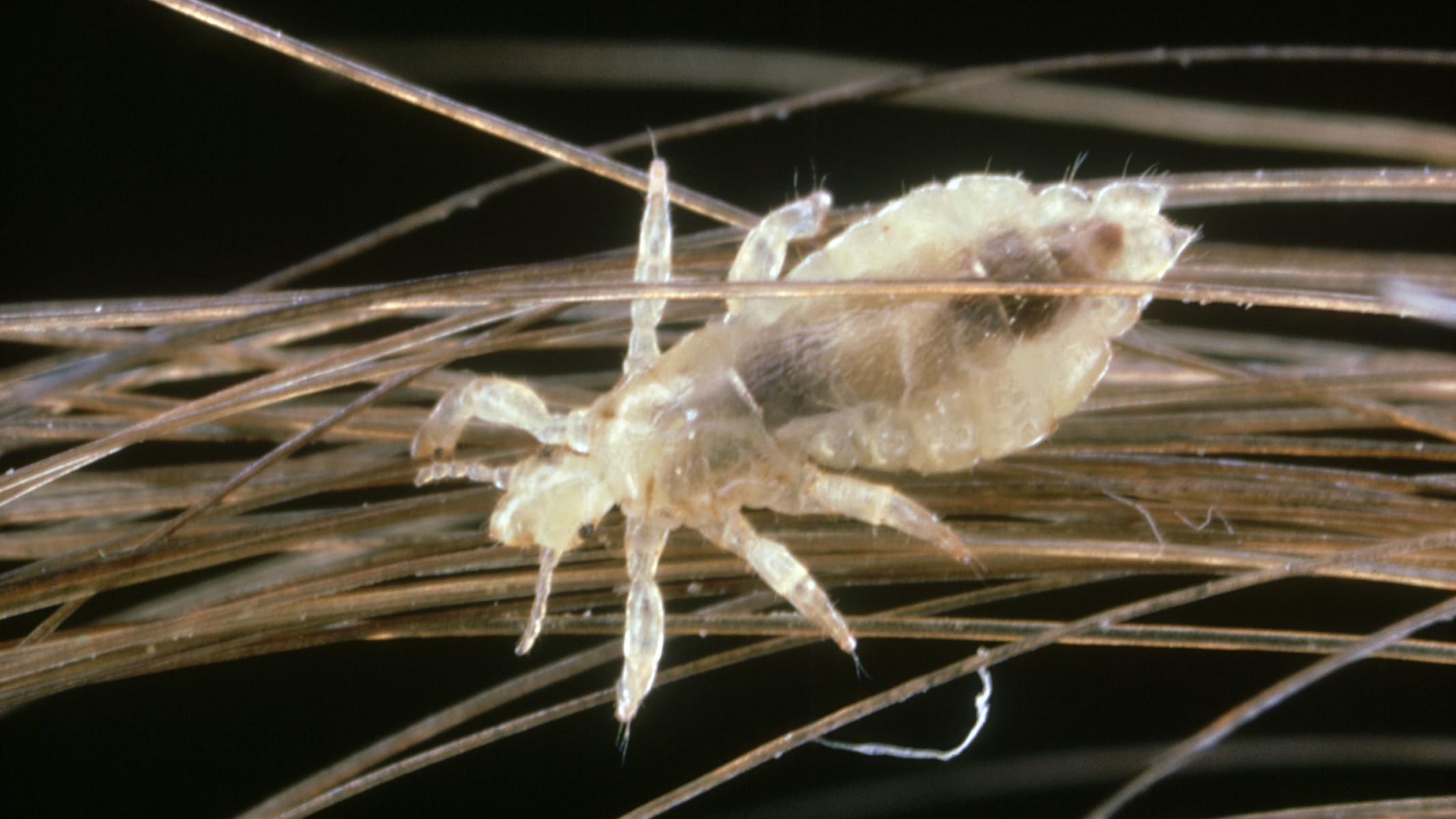 It's Head Lice Season. Here's What to Know It's Head Lice Season. Here's What to Know