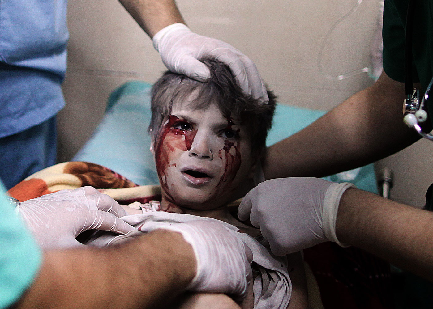 A Palestinian boy, who medics said was wounded by Israeli shelling, receives treatment at al-Shifa hospital in Gaza City July 20, 2014.