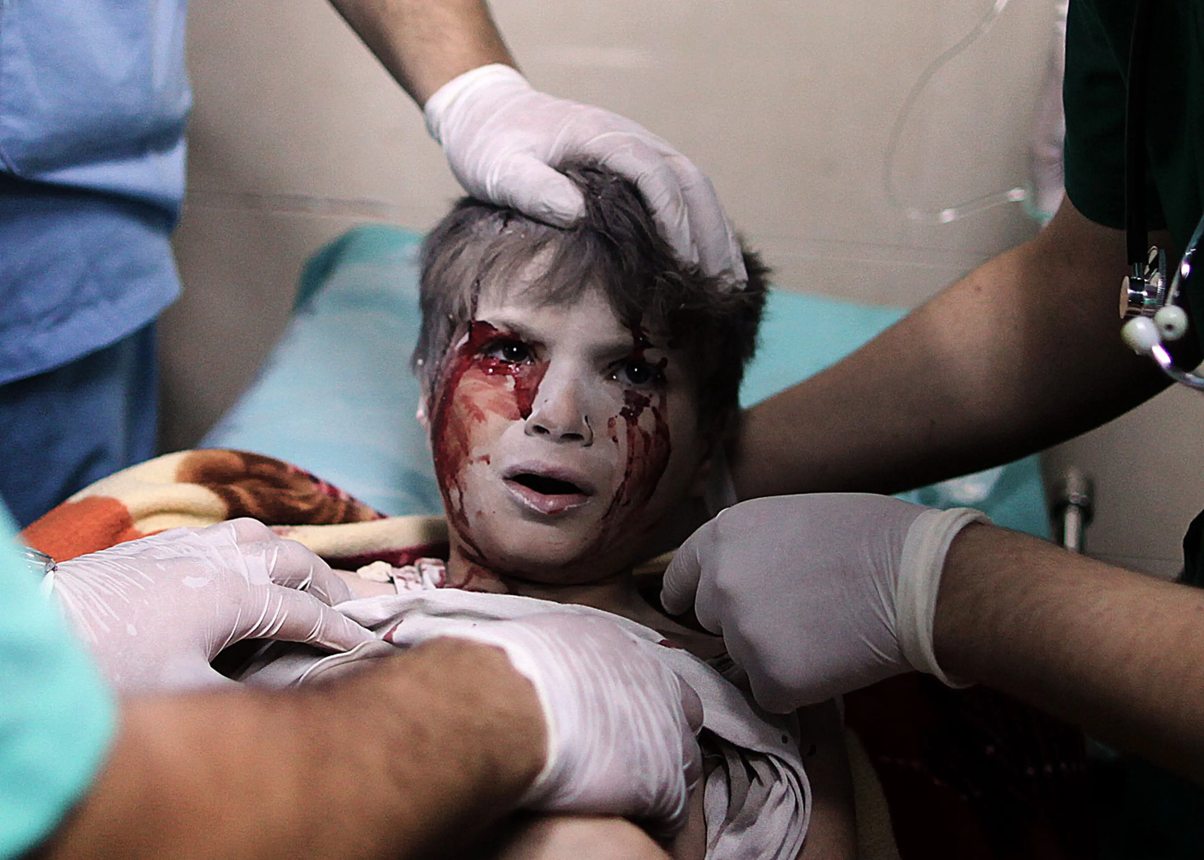 A Palestinian boy, who medics said was wounded by Israeli shelling, receives treatment at al-Shifa hospital in Gaza City July 20, 2014.