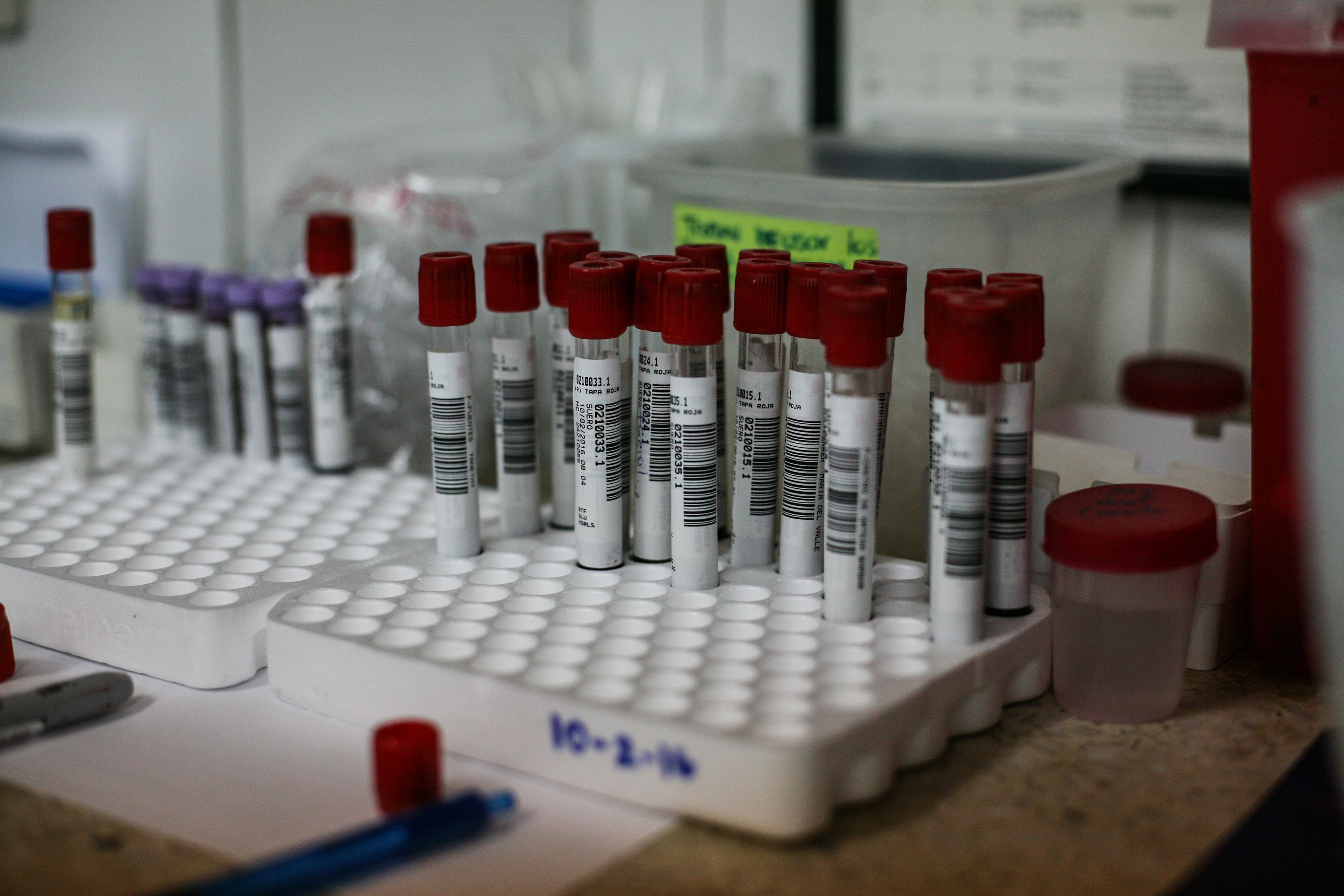 Test tubes are stored at the Salud Chacao Laboratory in Caracas, Venezuela, on Feb. 10, 2016.