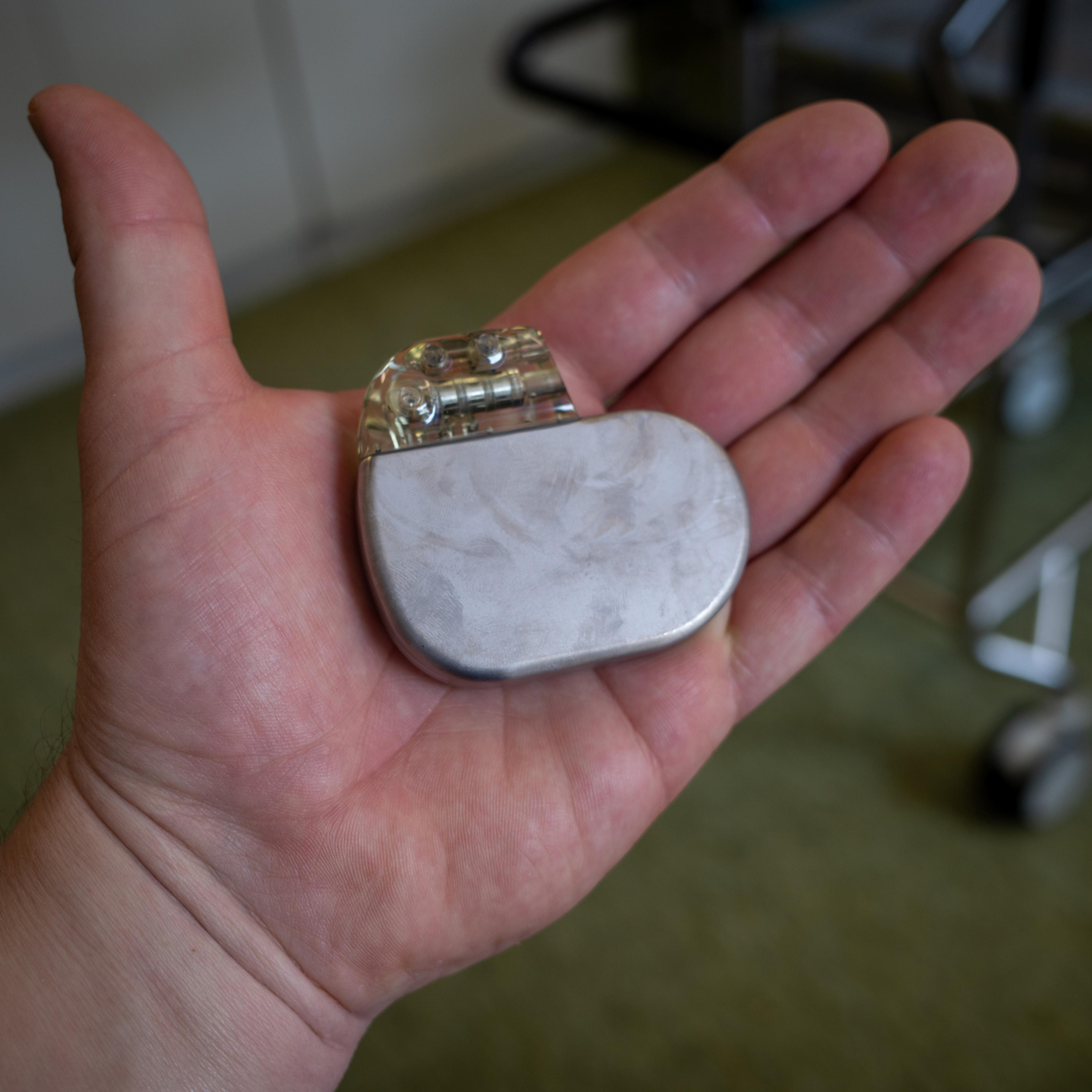 in a hand is an implantable defibrilator