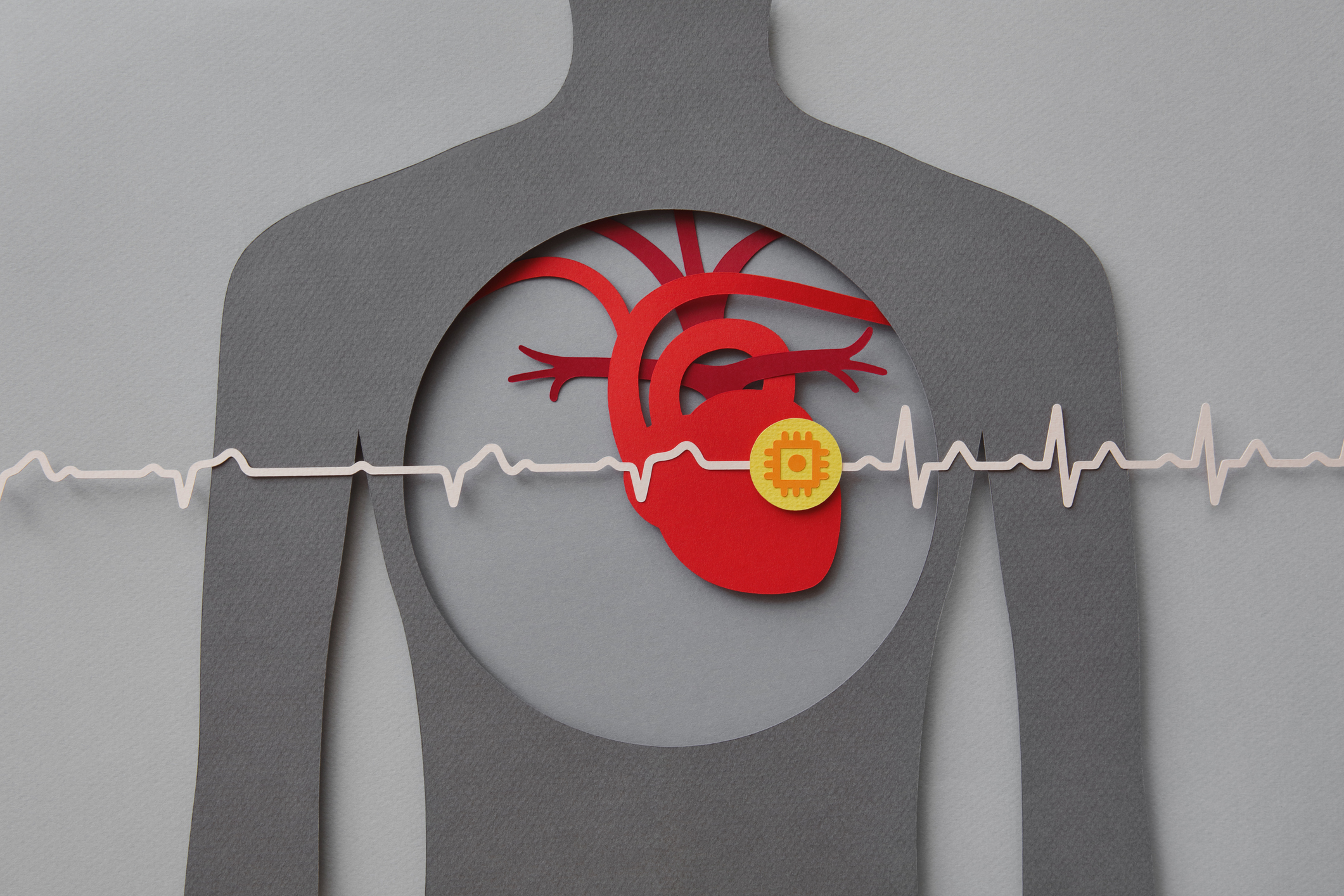 Heart with pacemaker