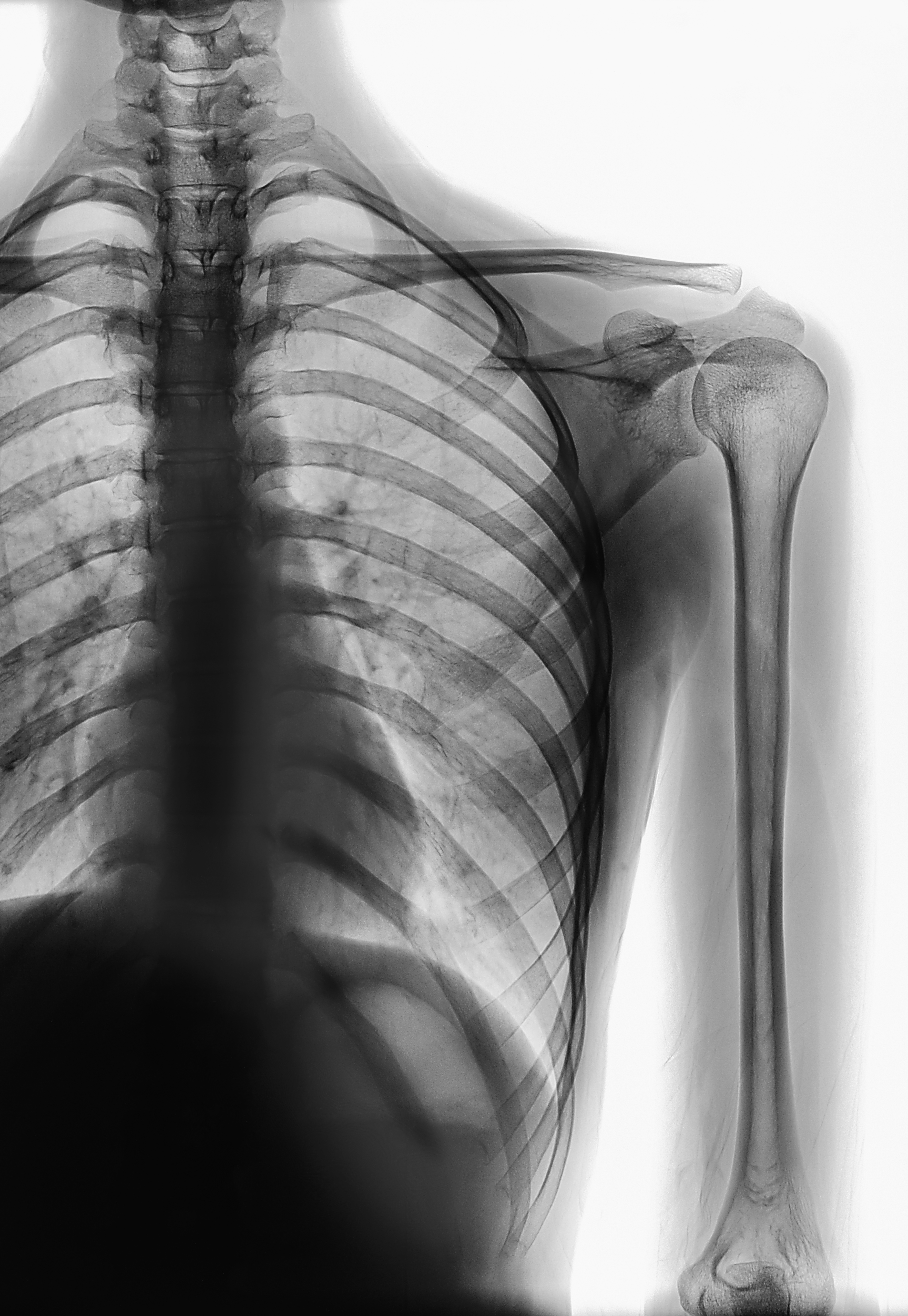 skeleton xray bones