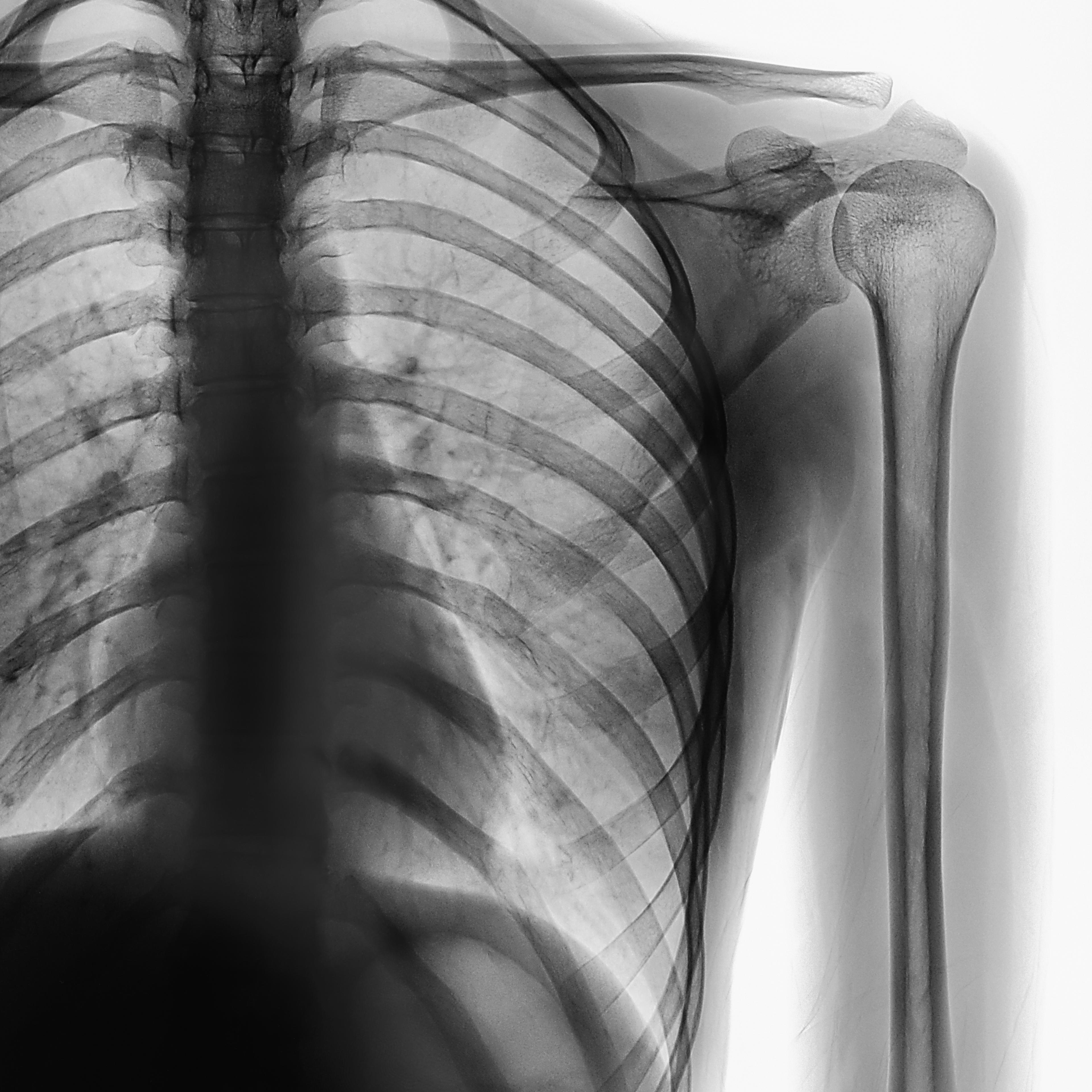 skeleton xray bones