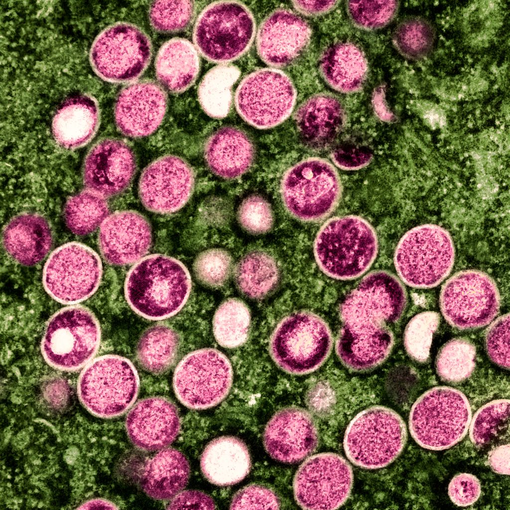 Mpox virus