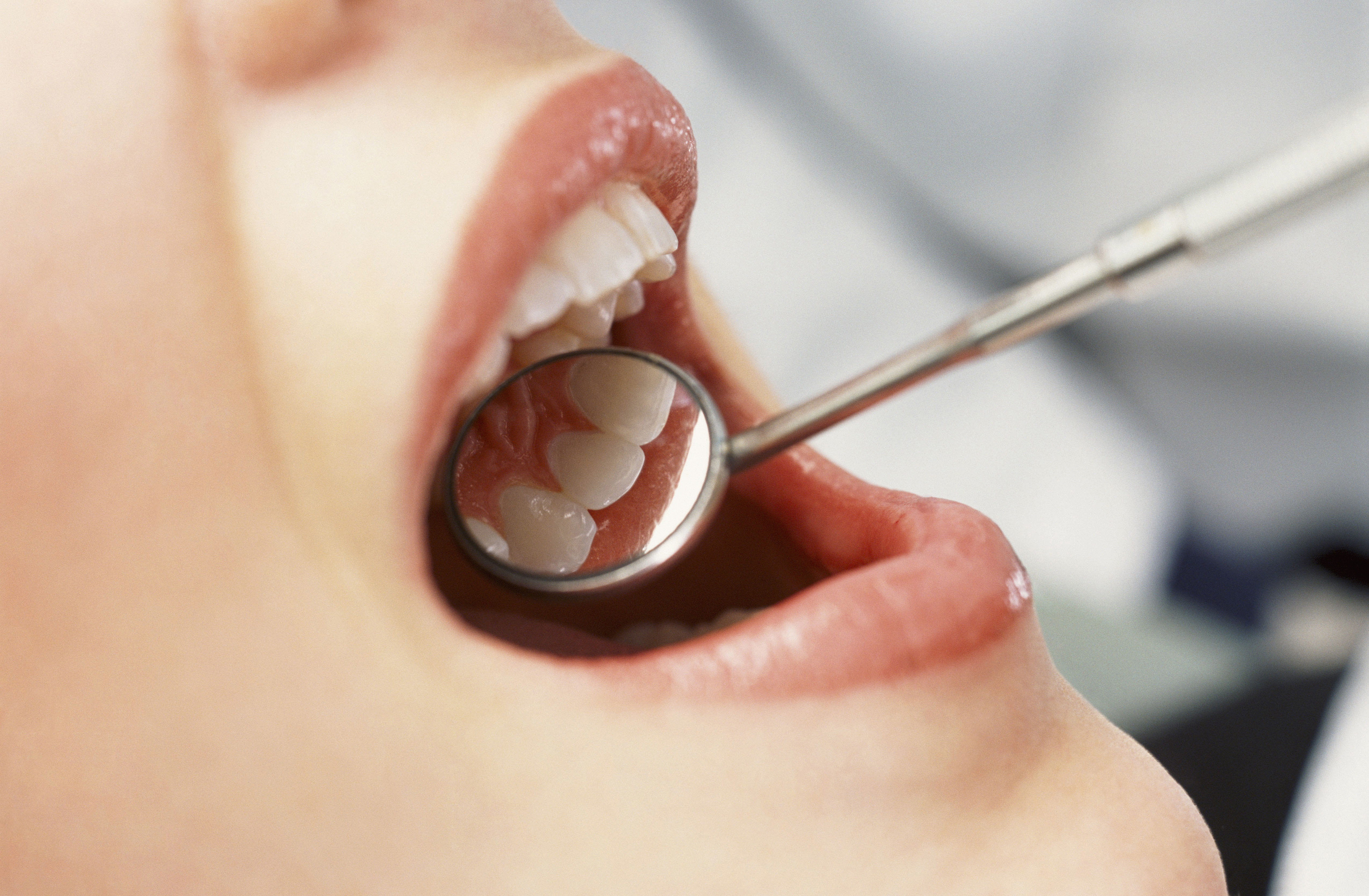 Dental check-up