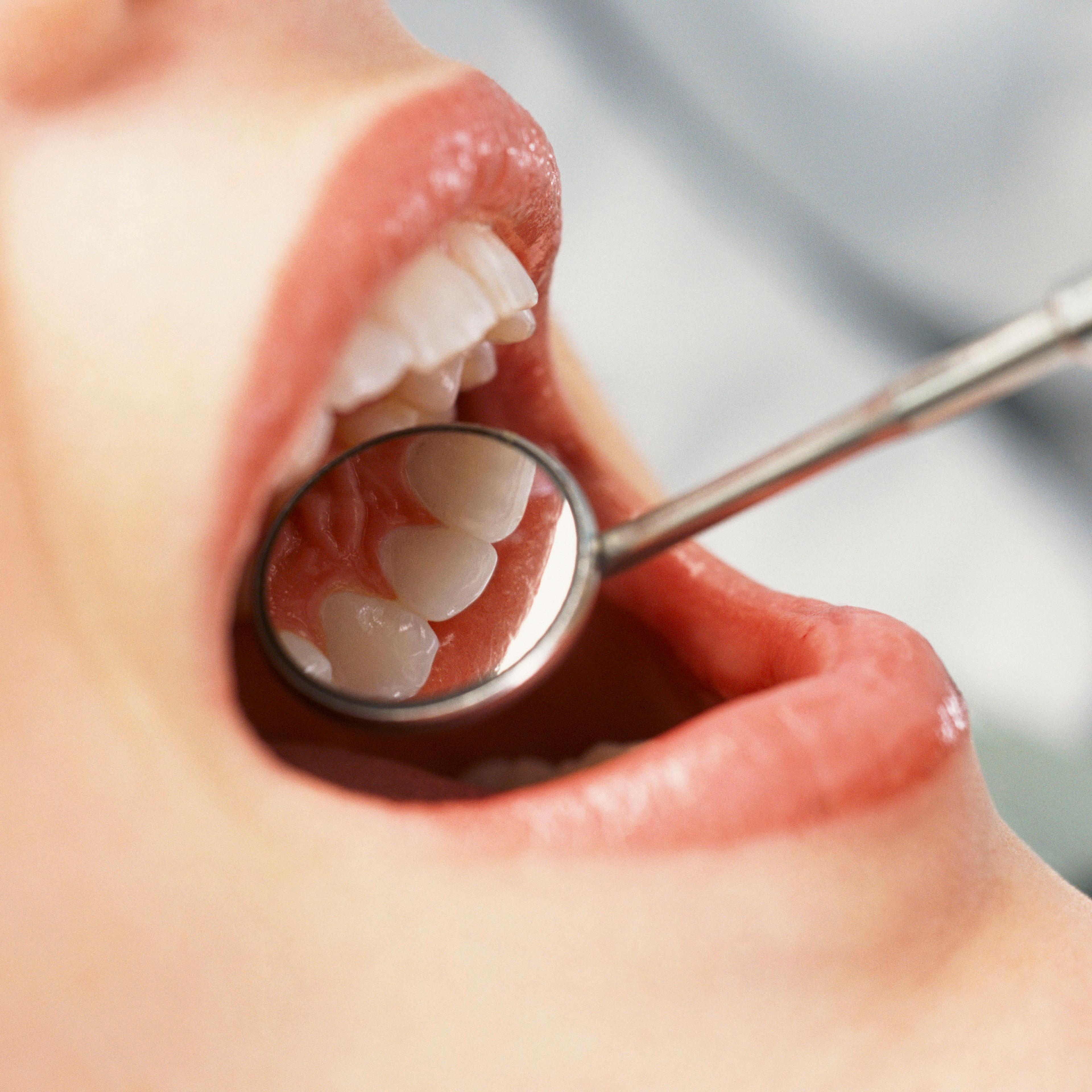 Dental check-up