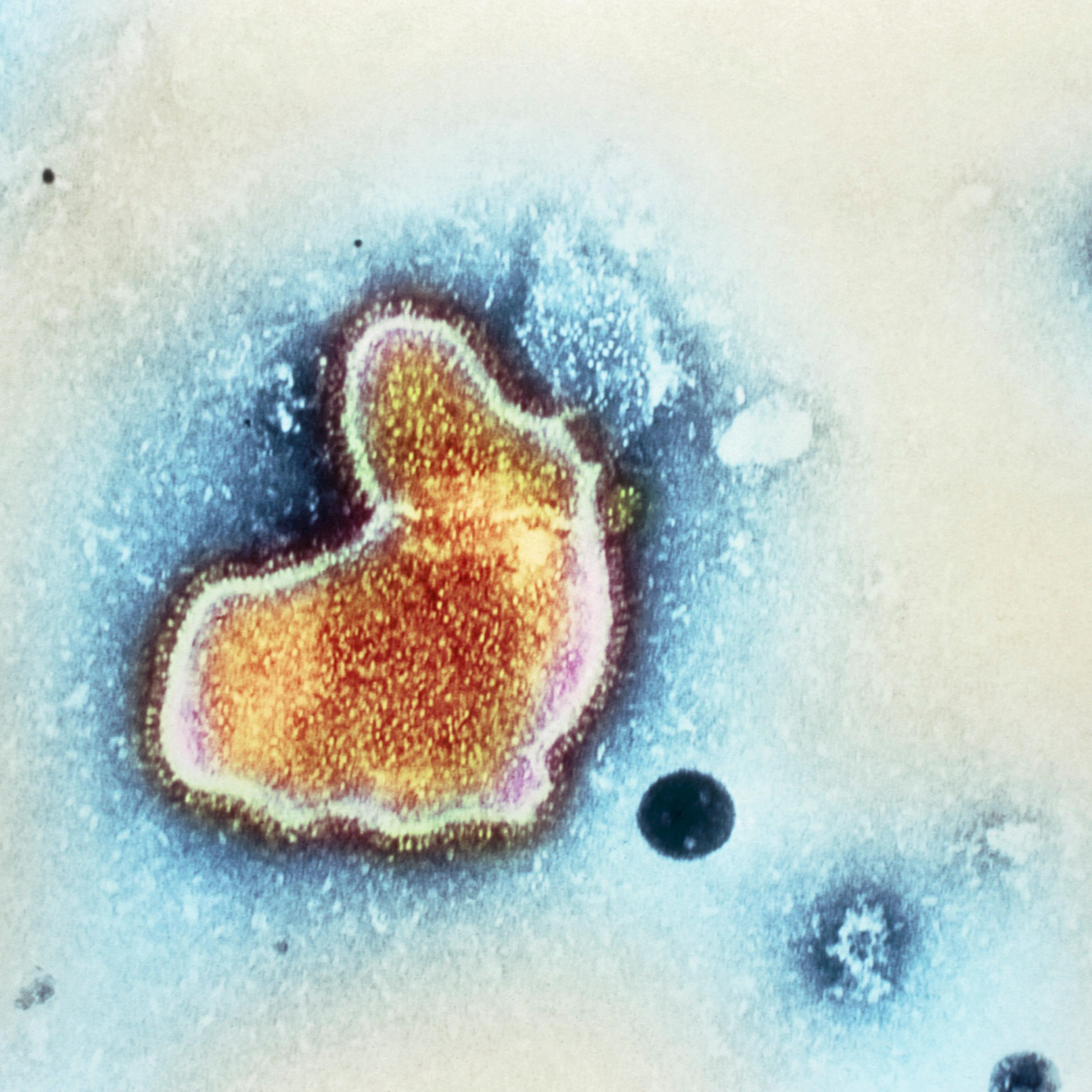 Respiratory syncytial virus