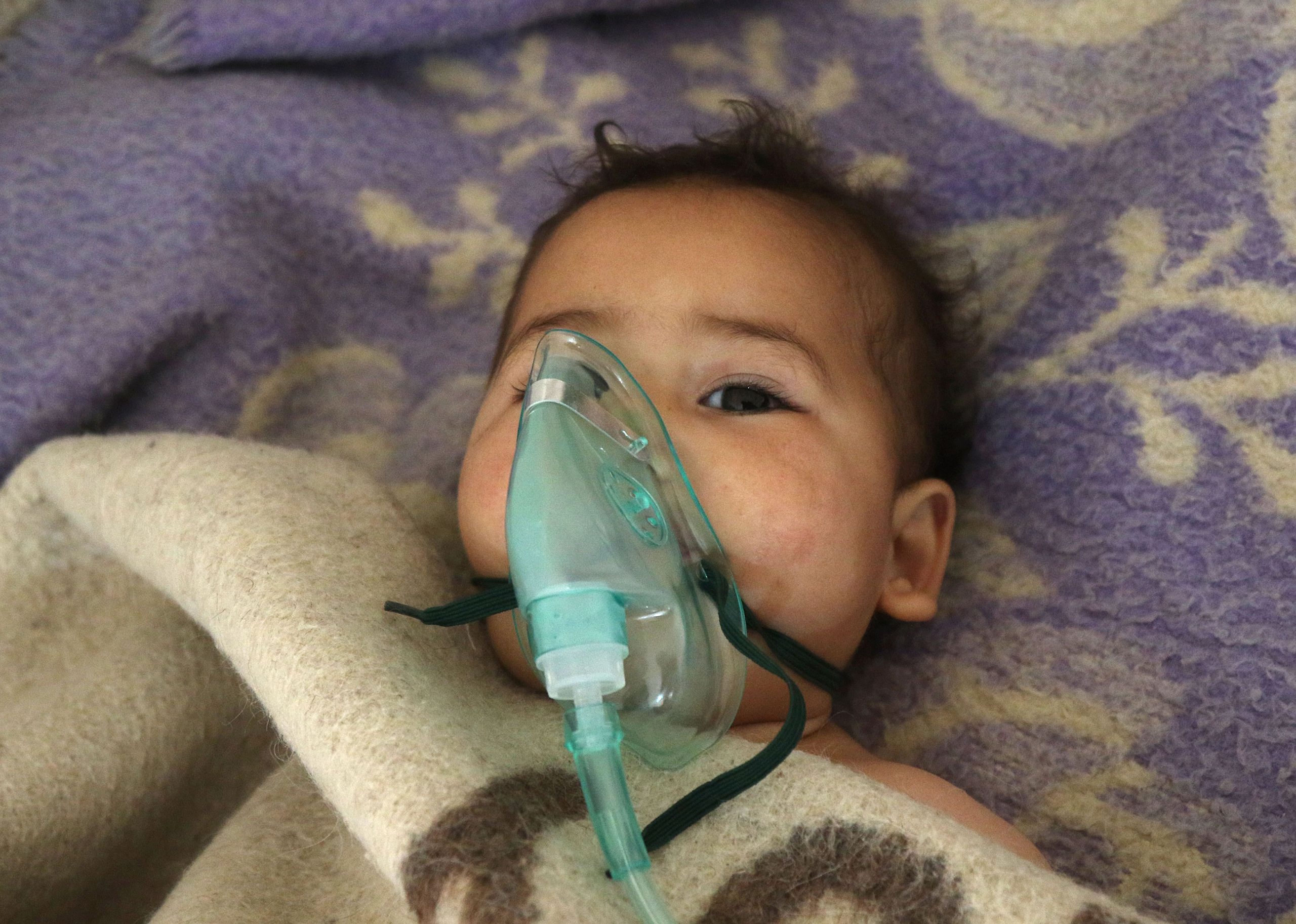 A Syrian child receives treatment after a suspected gas attack at a small hospital in Maaret al-Noman, a rebel-held town in Idlib province, on April 4, 2017. The Syrian Observatory for Human Rights said those killed in the town of Khan Sheikhun, in Idlib