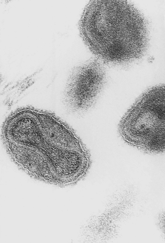 The Smallpox