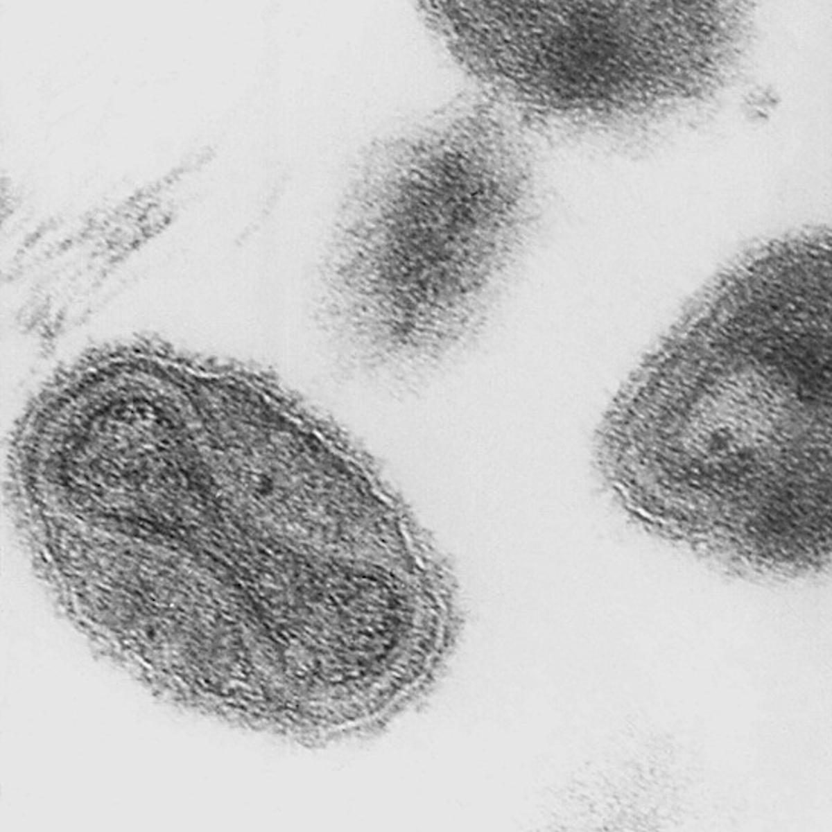 The Smallpox