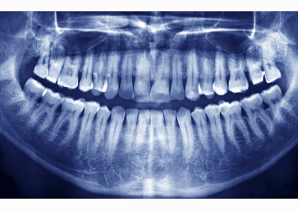 Dental X-Ray Teeth