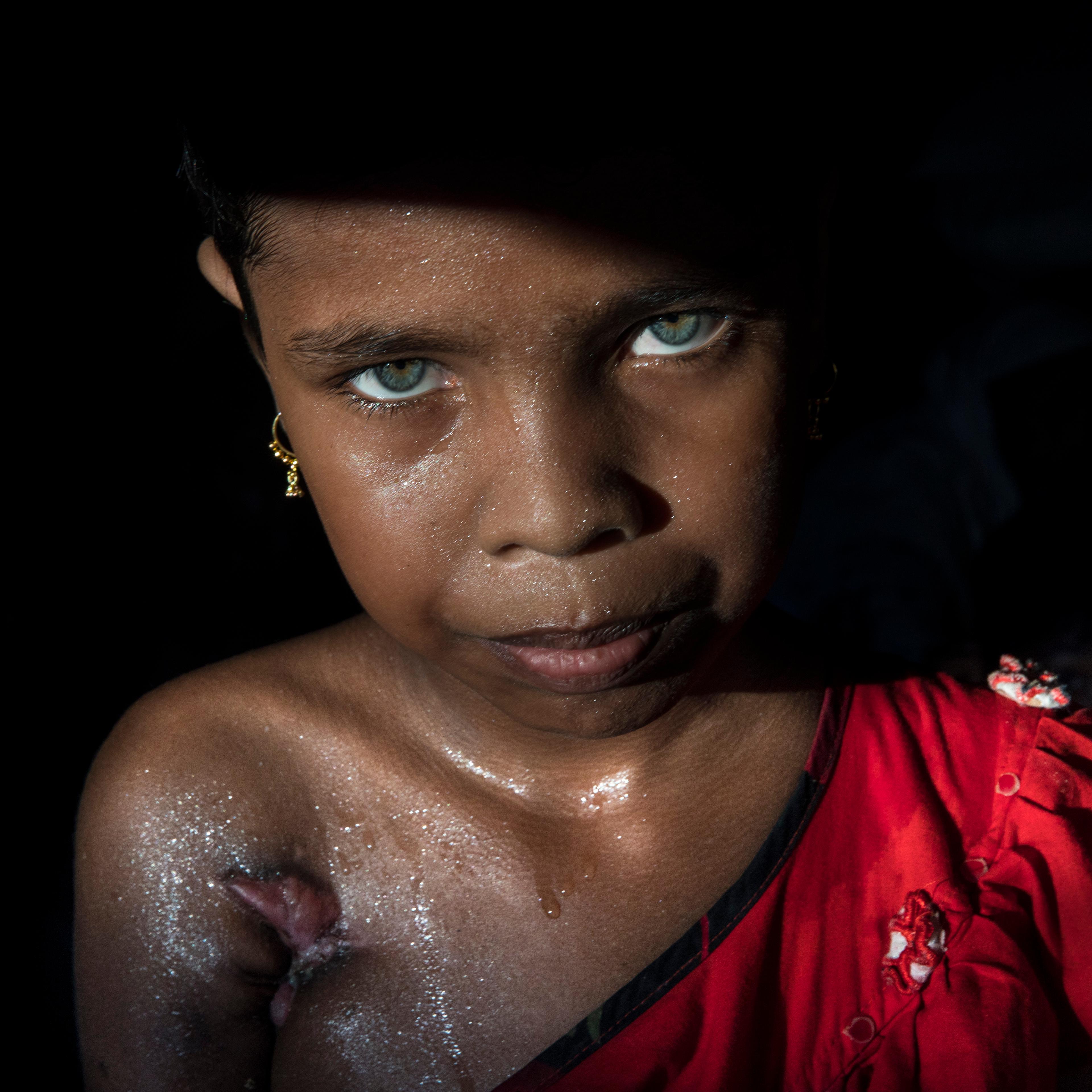 Rohingya Refugees Flood Into Bangladesh
