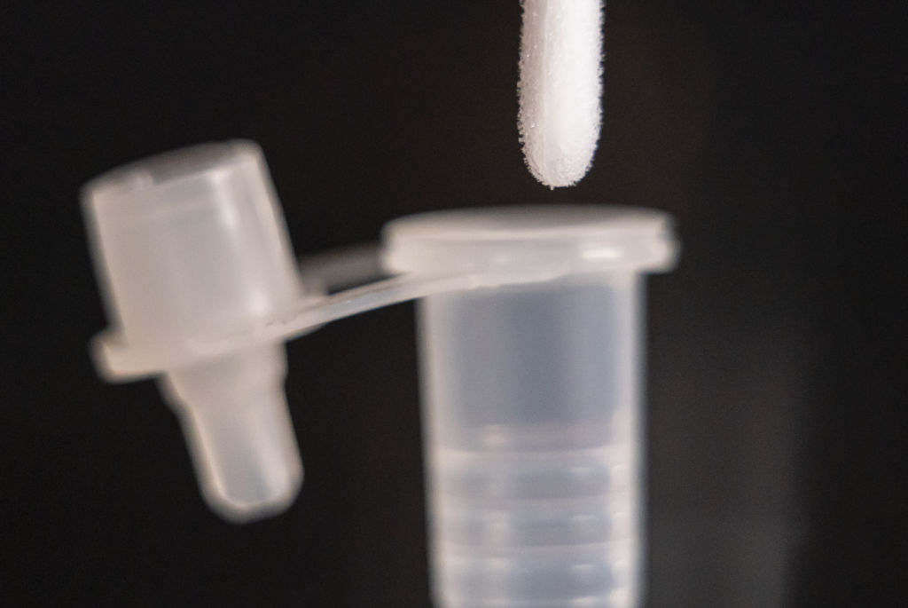 Coronavirus lateral flow test