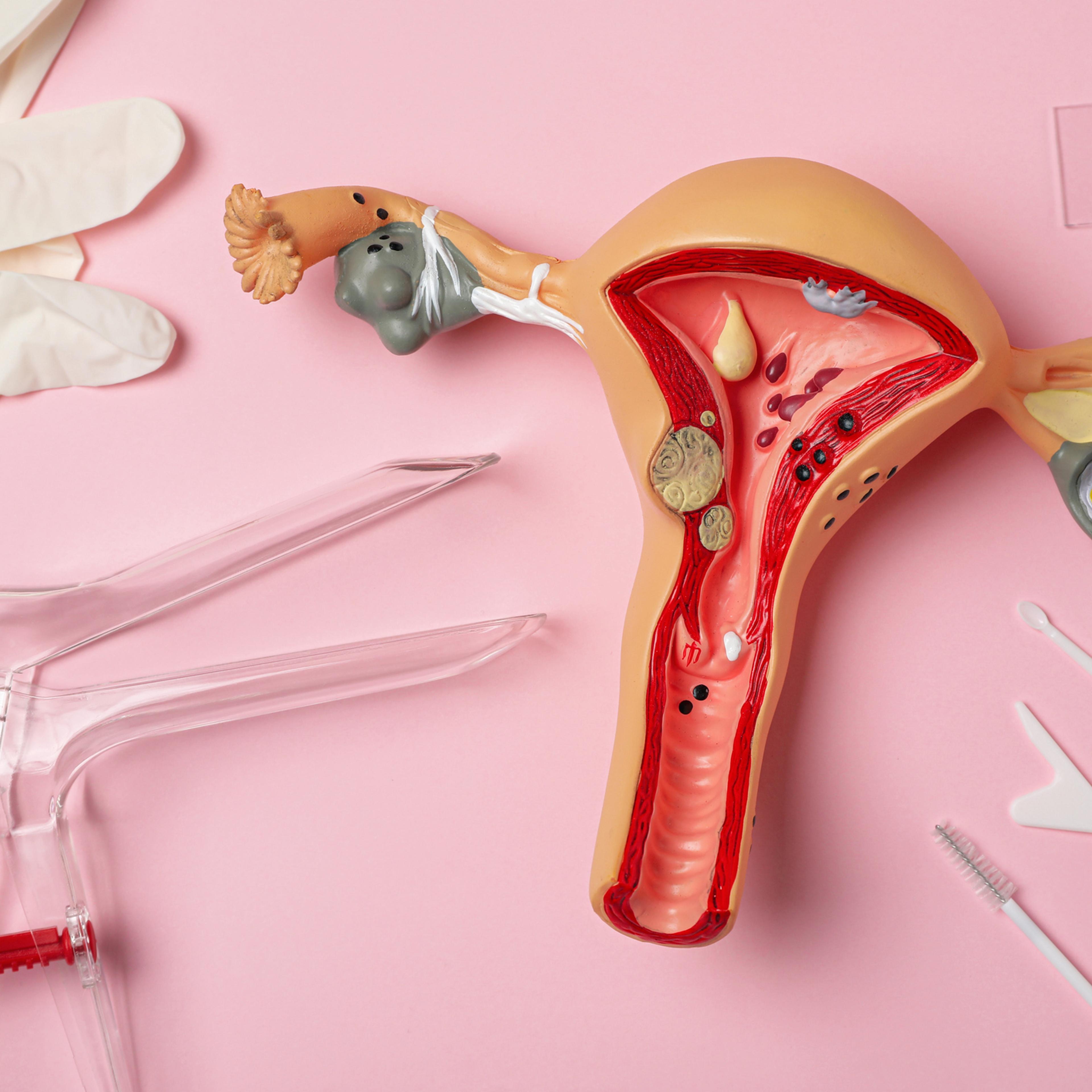 Gynecological examination kit and anatomical uterus model on pink background, flat lay
