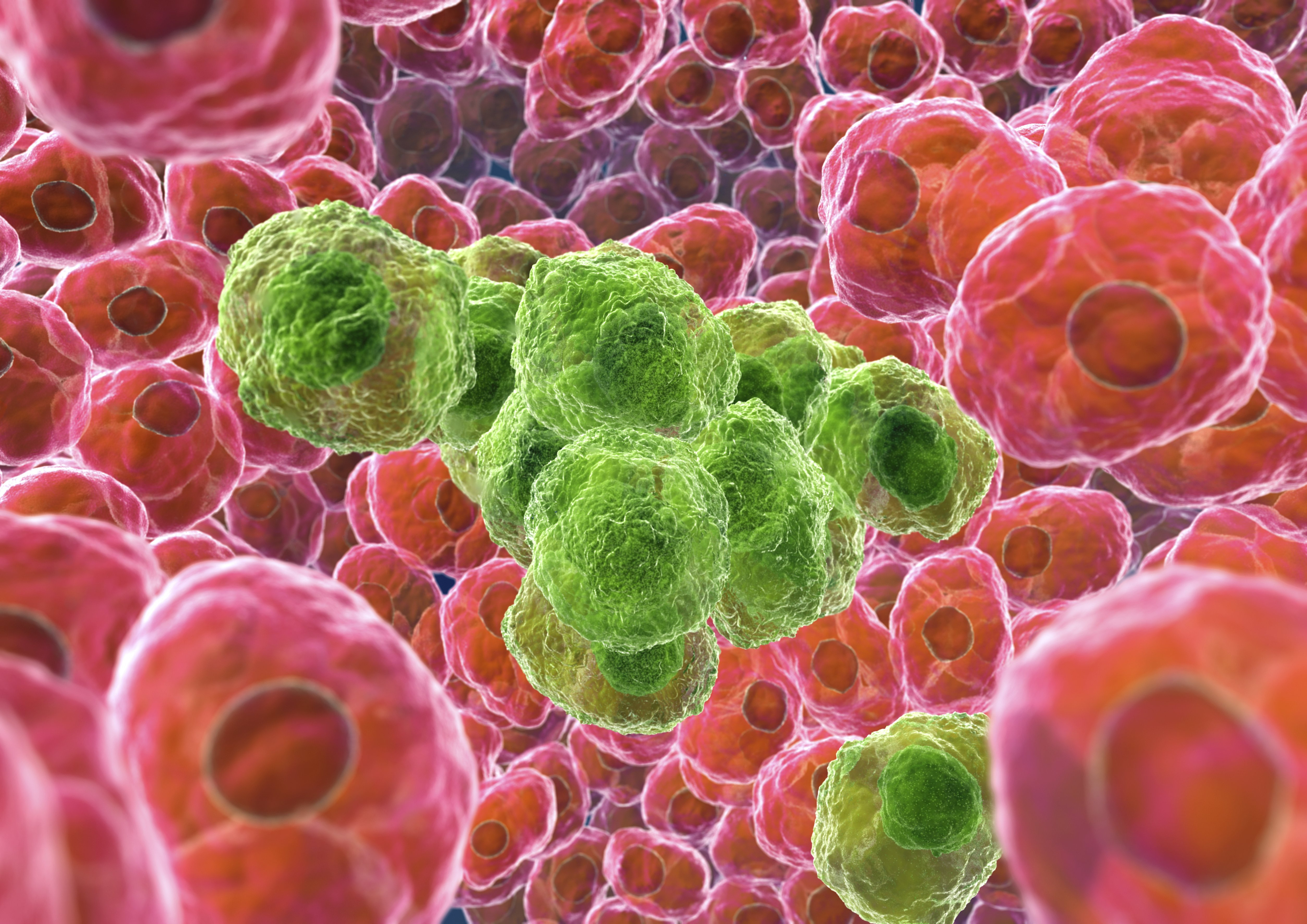 Cancer cells, artwork