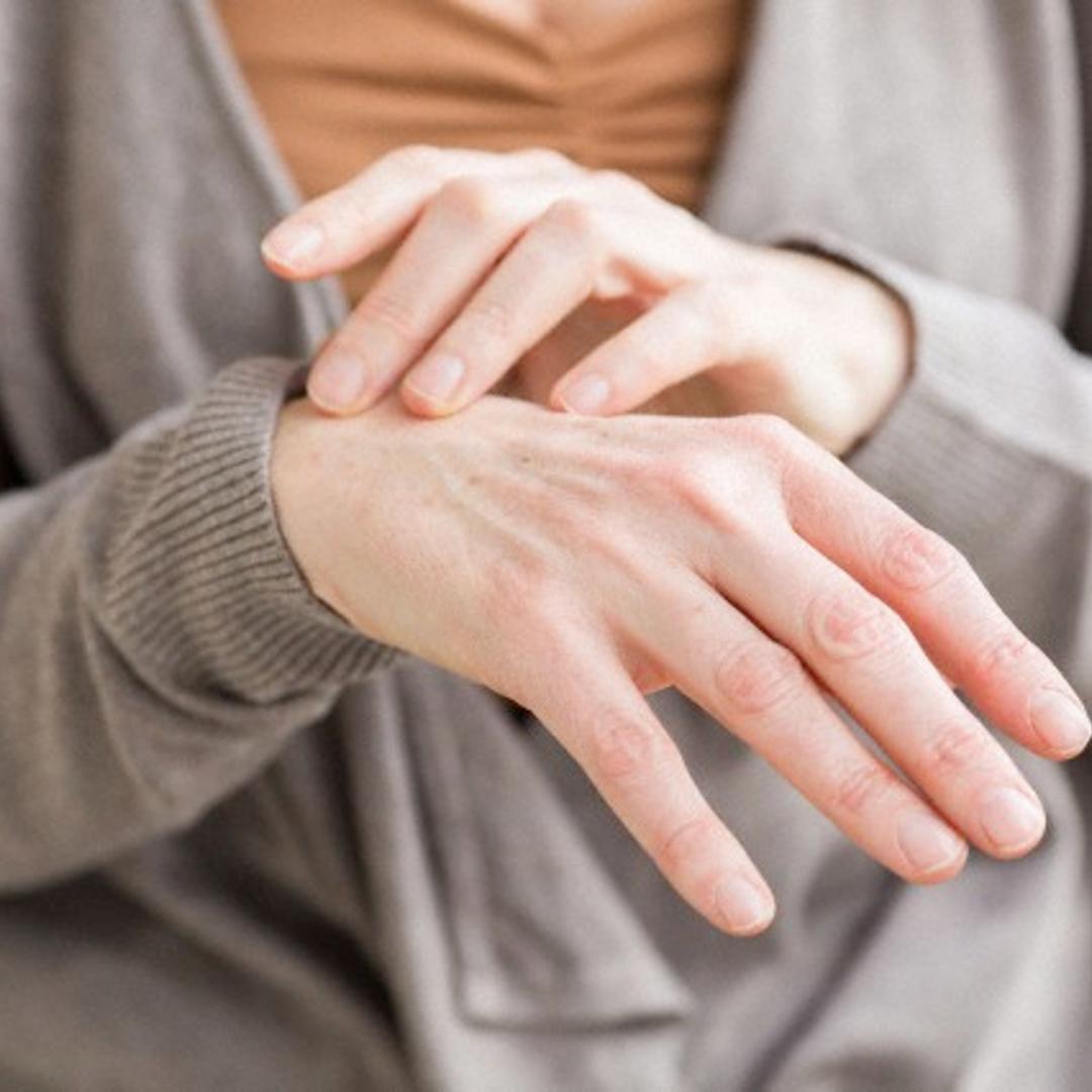 hand-skin-scratch