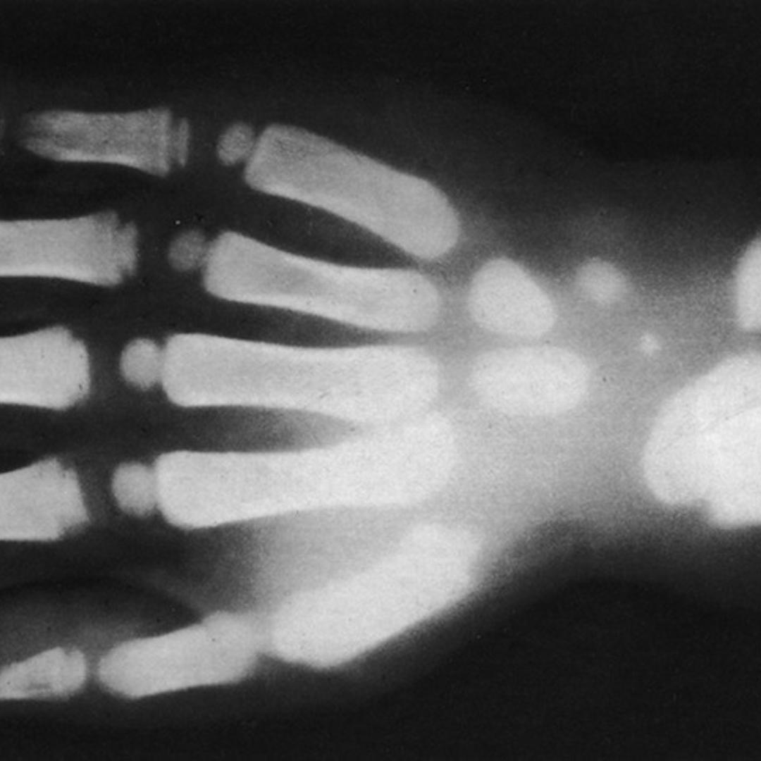 X-Ray Hand