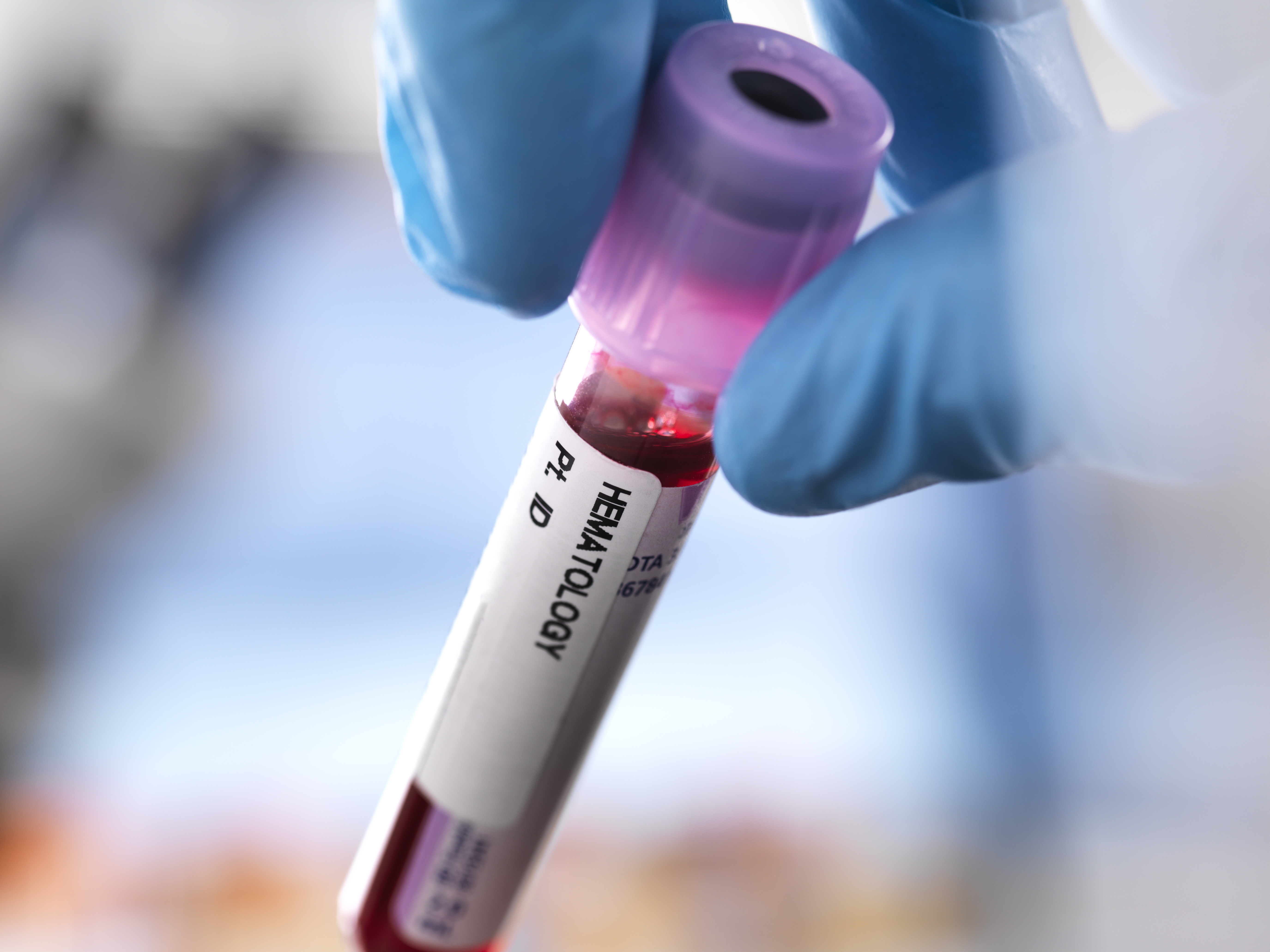 Cropped view of doctor holding vial of blood