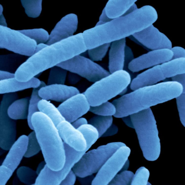 Escherichia coli bacteria by scanning electron microscopy (SEM).