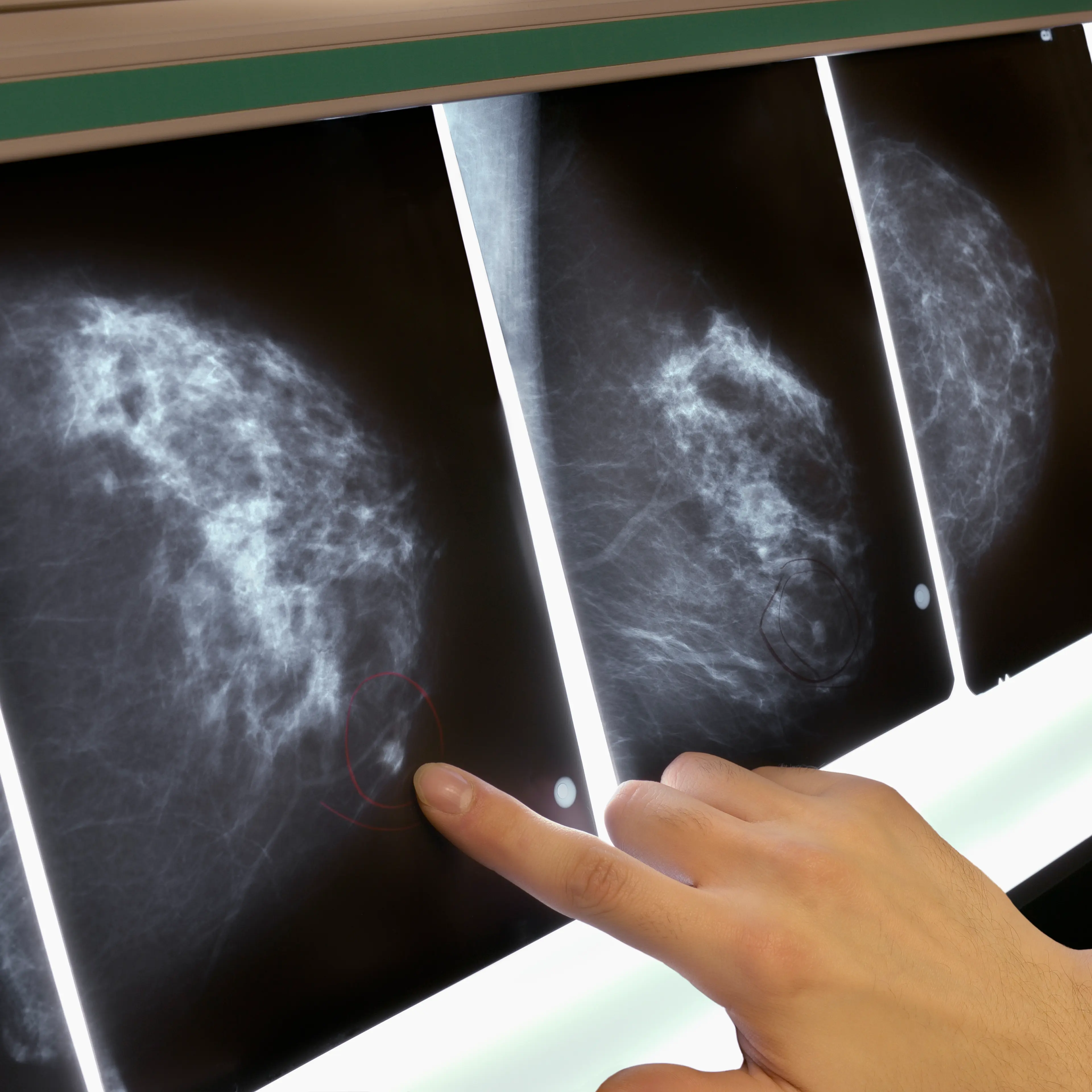 Woman pointing to area on mammogram x-ray, close-up