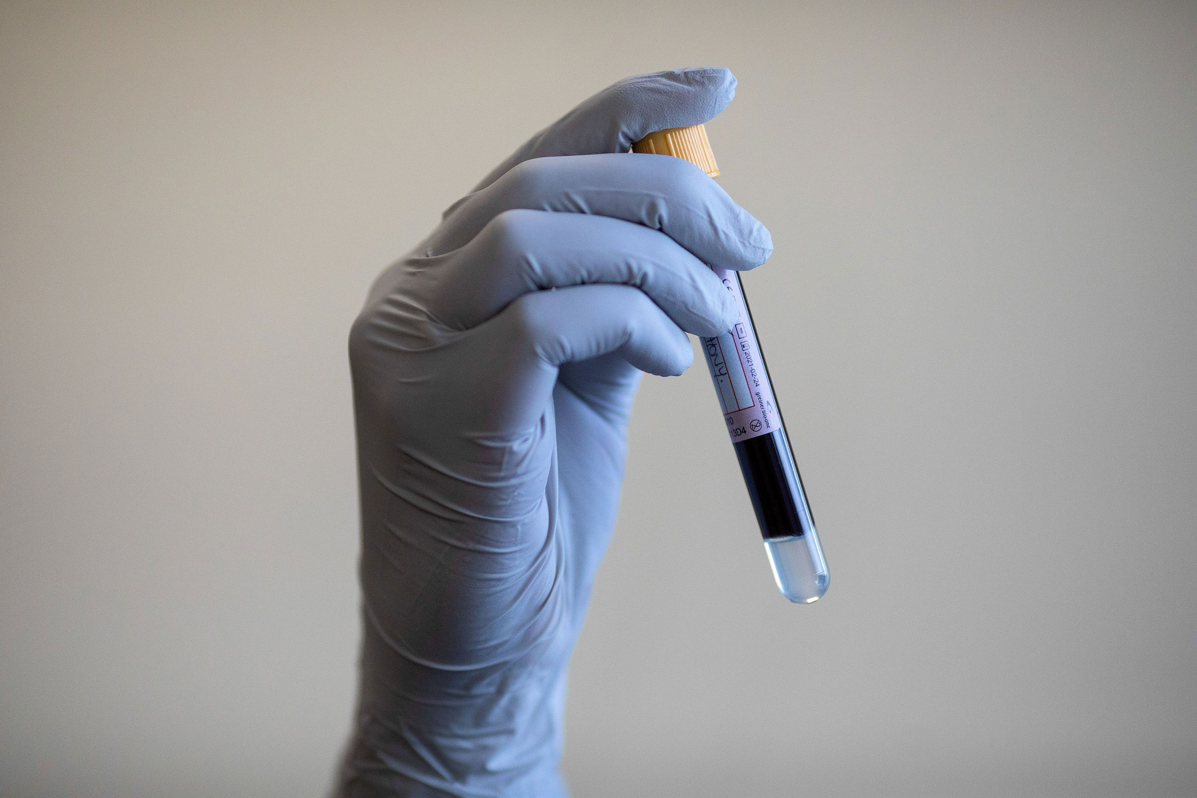 NHS Antibody Testing At West Midlands Ambulance Service, Birmingham, United Kingdom - 05 Jun 2020